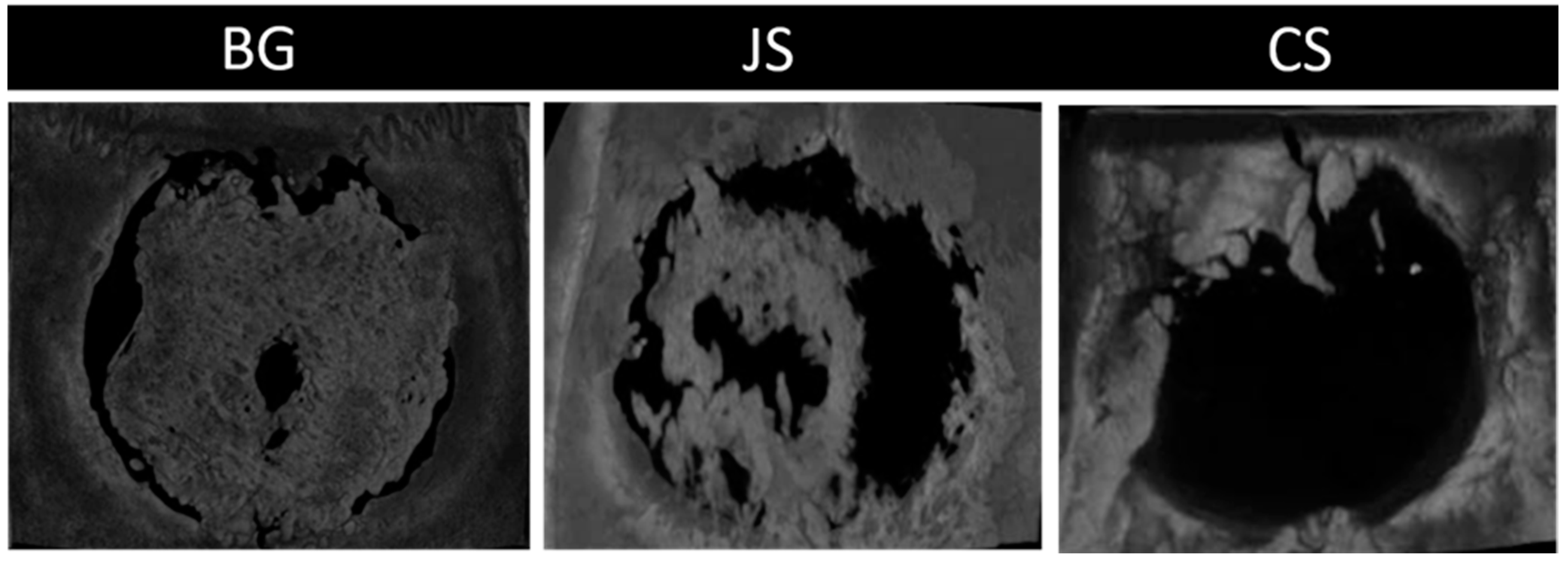 Membranes 12 00461 g010