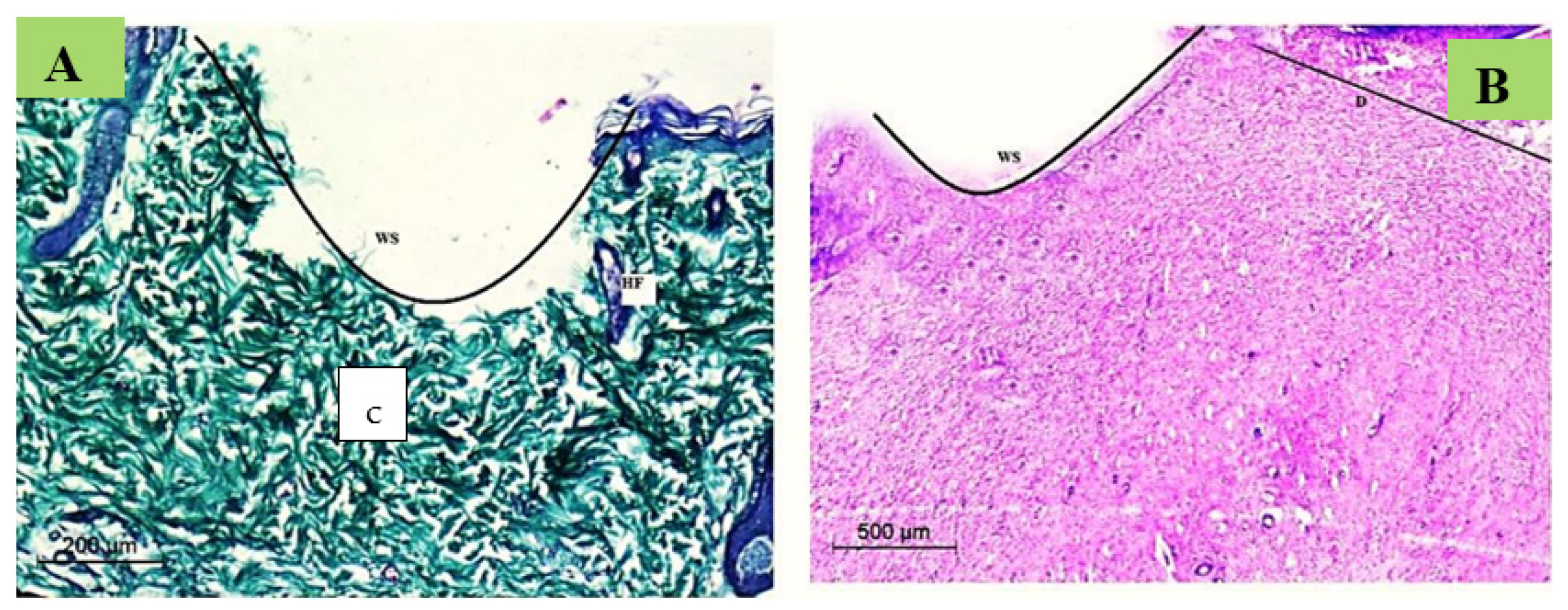 Membranes 12 00536 g011