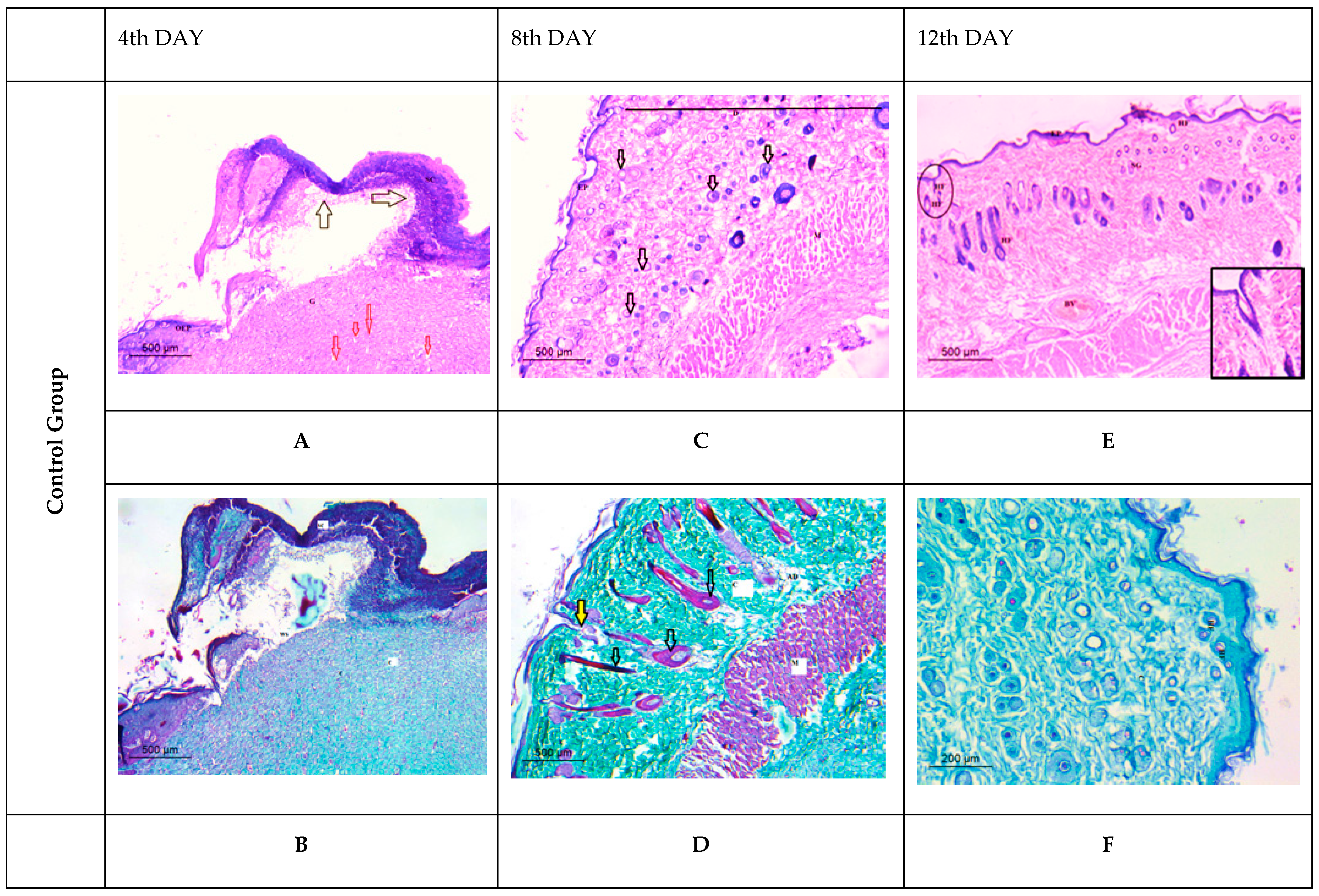 Membranes 12 00536 g012a