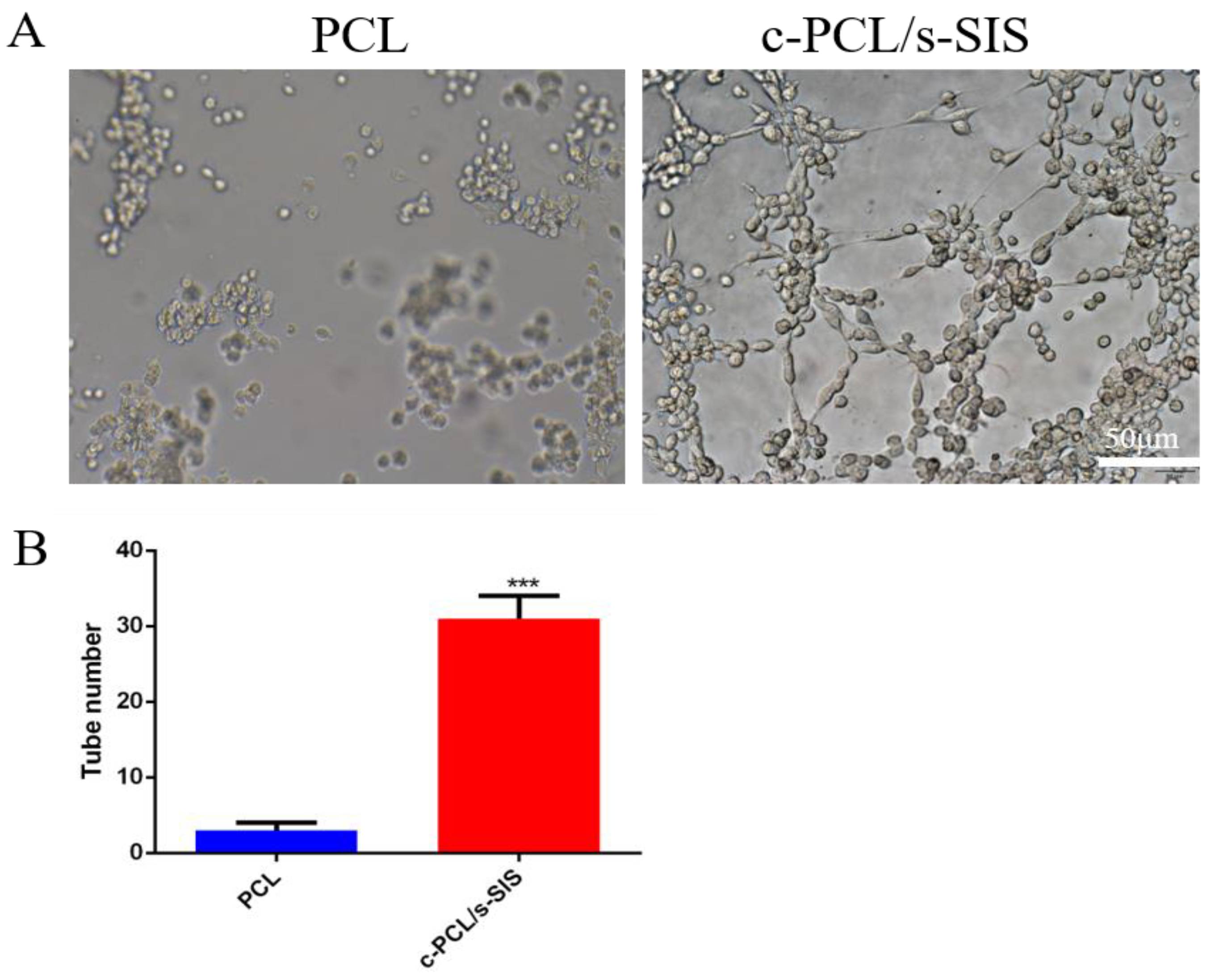 Small Intestinal Submucosa Biomimetic Periosteum Promotes