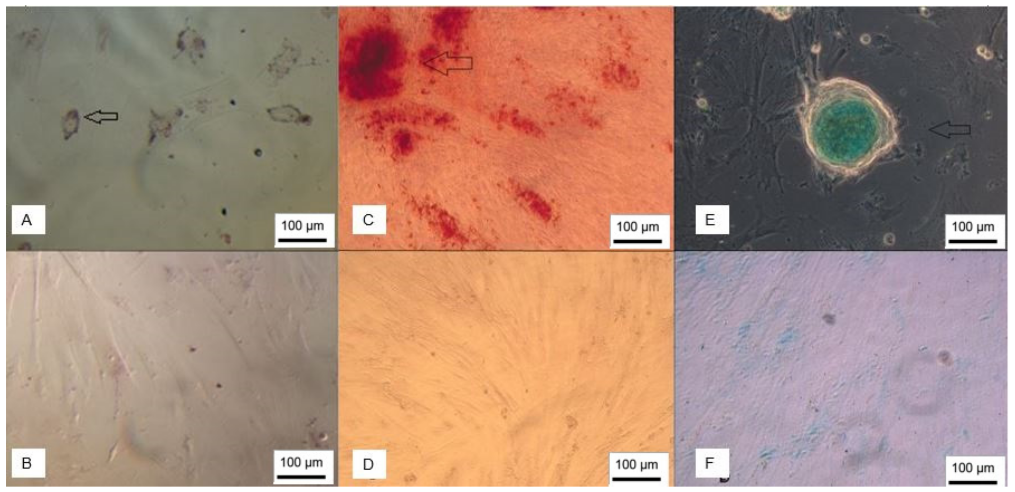 Membranes 12 00873 g003
