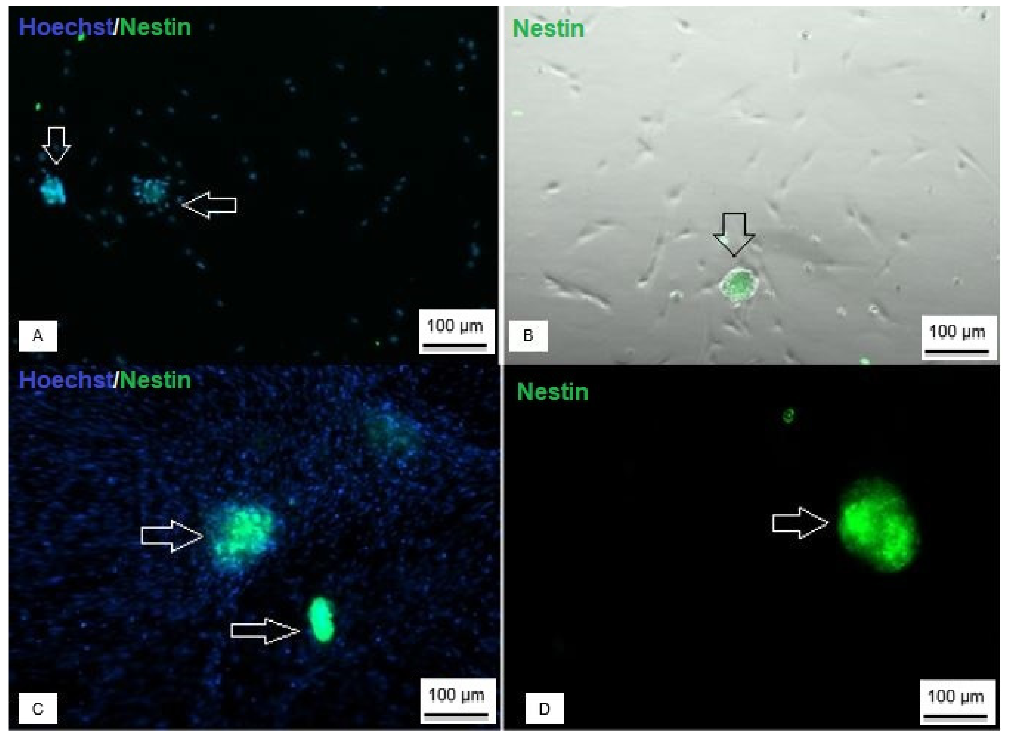 Membranes 12 00873 g008