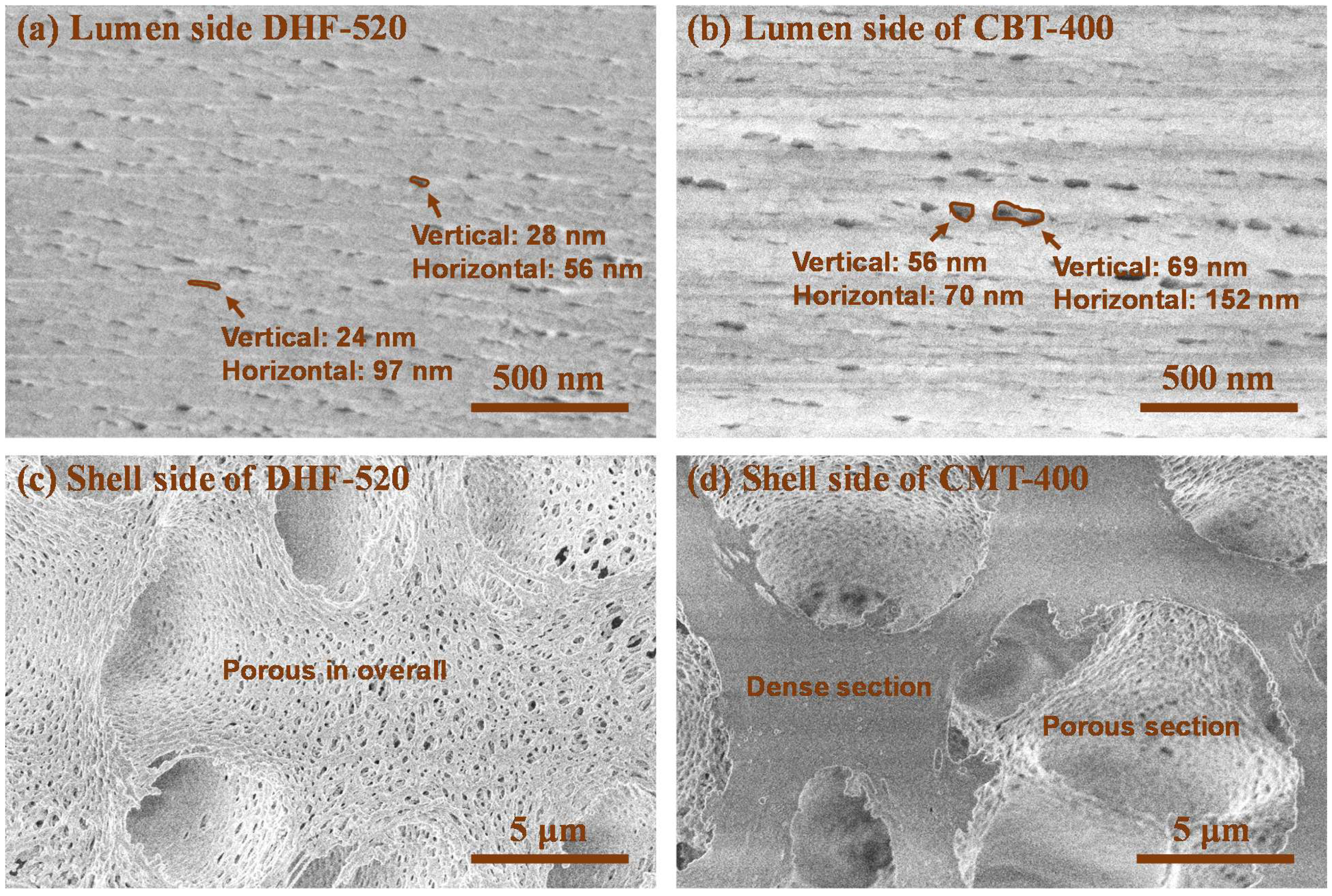 Membranes 12 01140 g006 Membranes 12 01140 g006