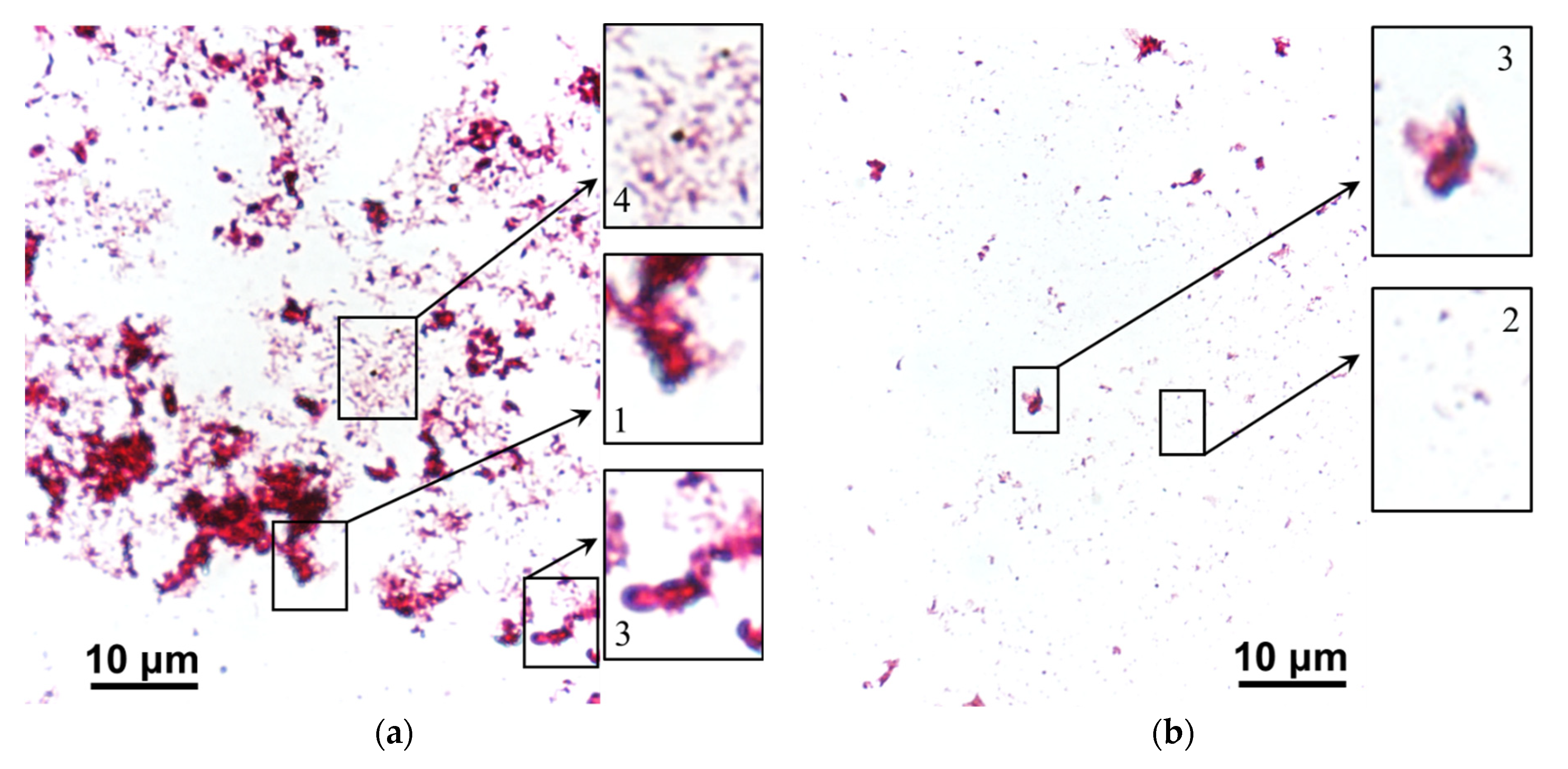 Membranes 12 01187 g014