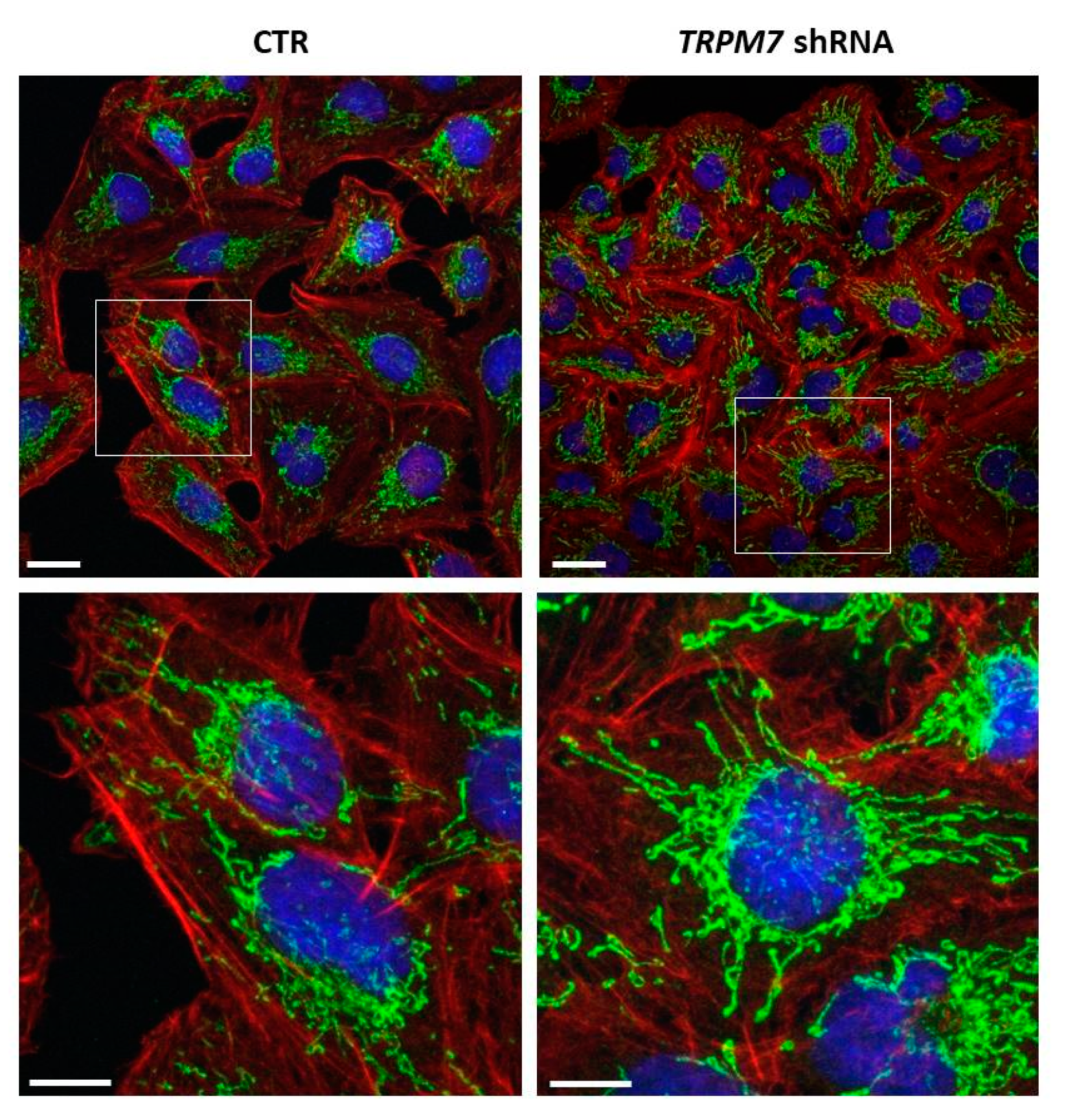 Membranes 13 00286 g003