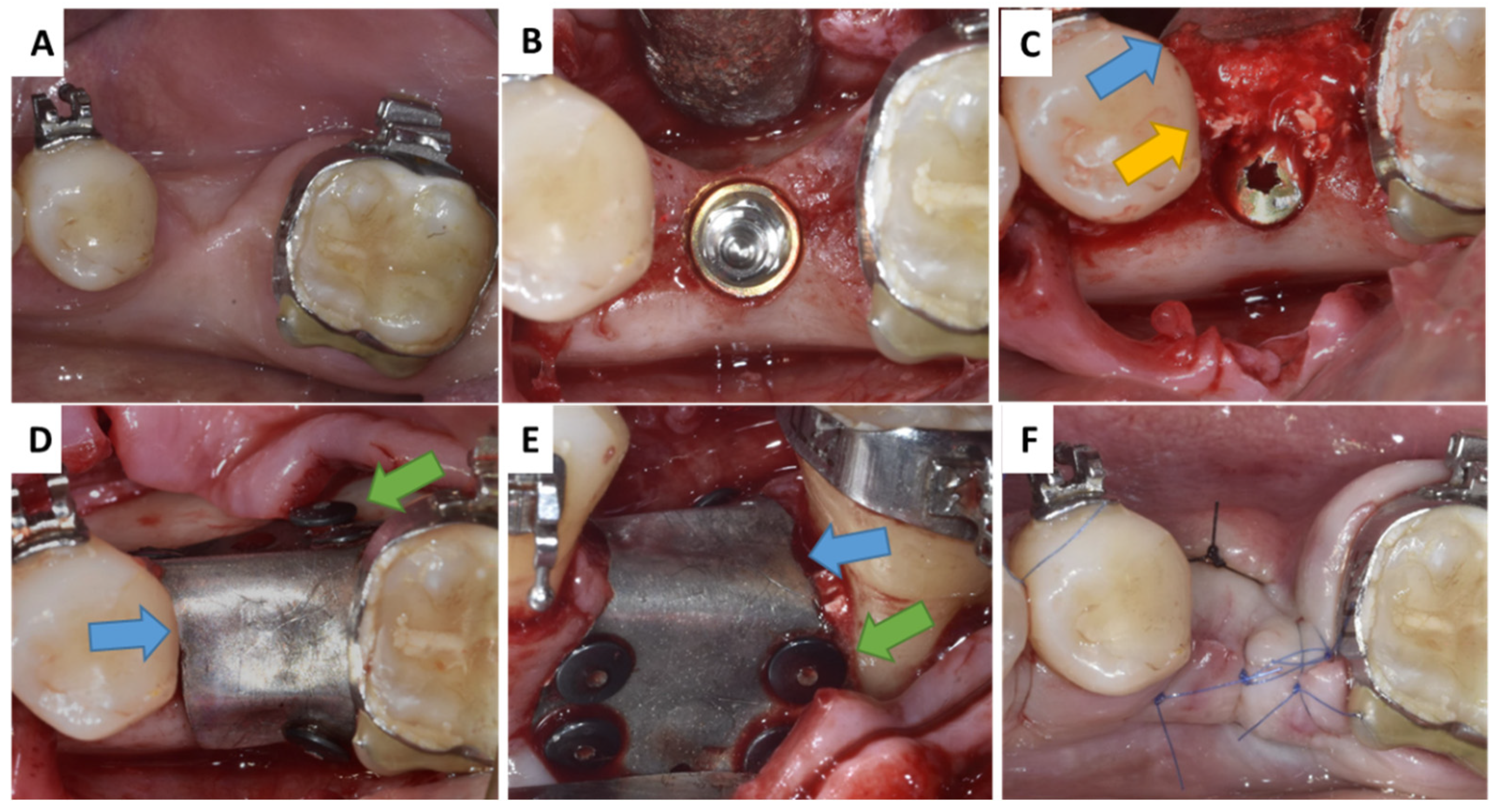 Membranes 13 00691 g001 Membranes 13 00691 g001