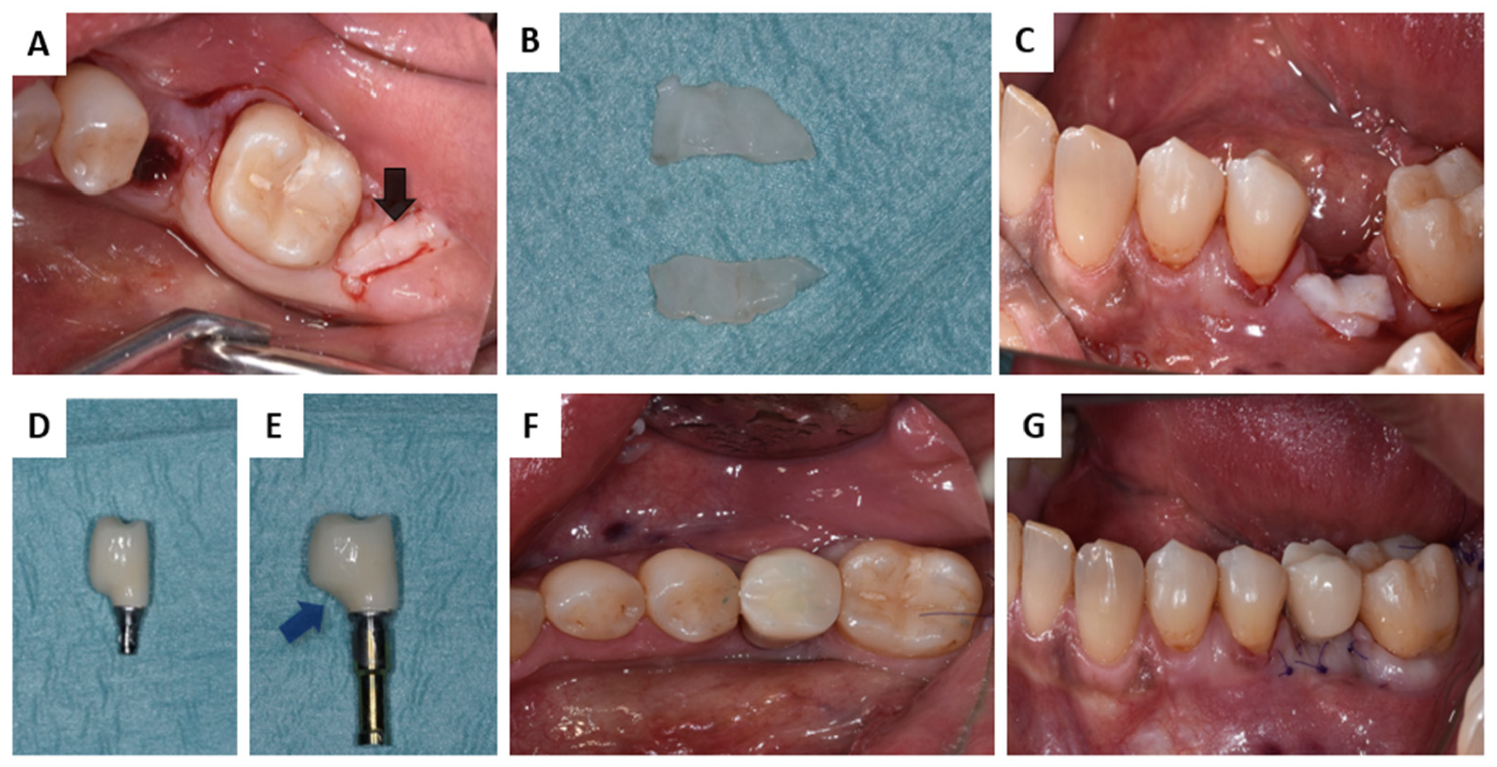 Membranes 13 00691 g002 Membranes 13 00691 g002