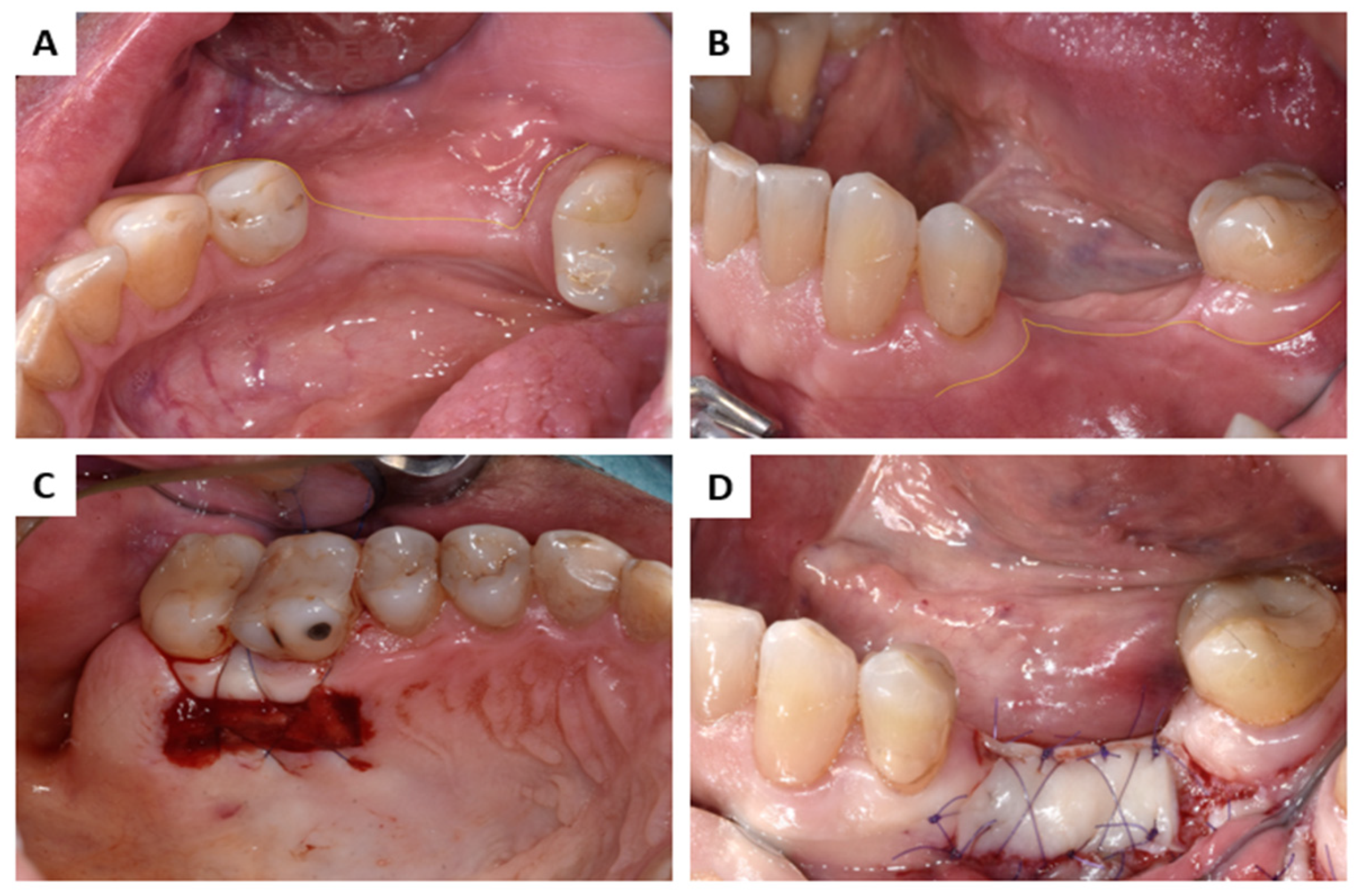 Membranes 13 00691 g004 Membranes 13 00691 g004