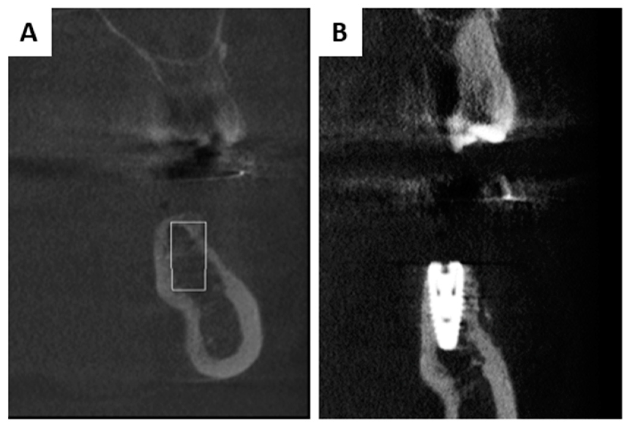 Membranes 13 00691 g007 Membranes 13 00691 g007