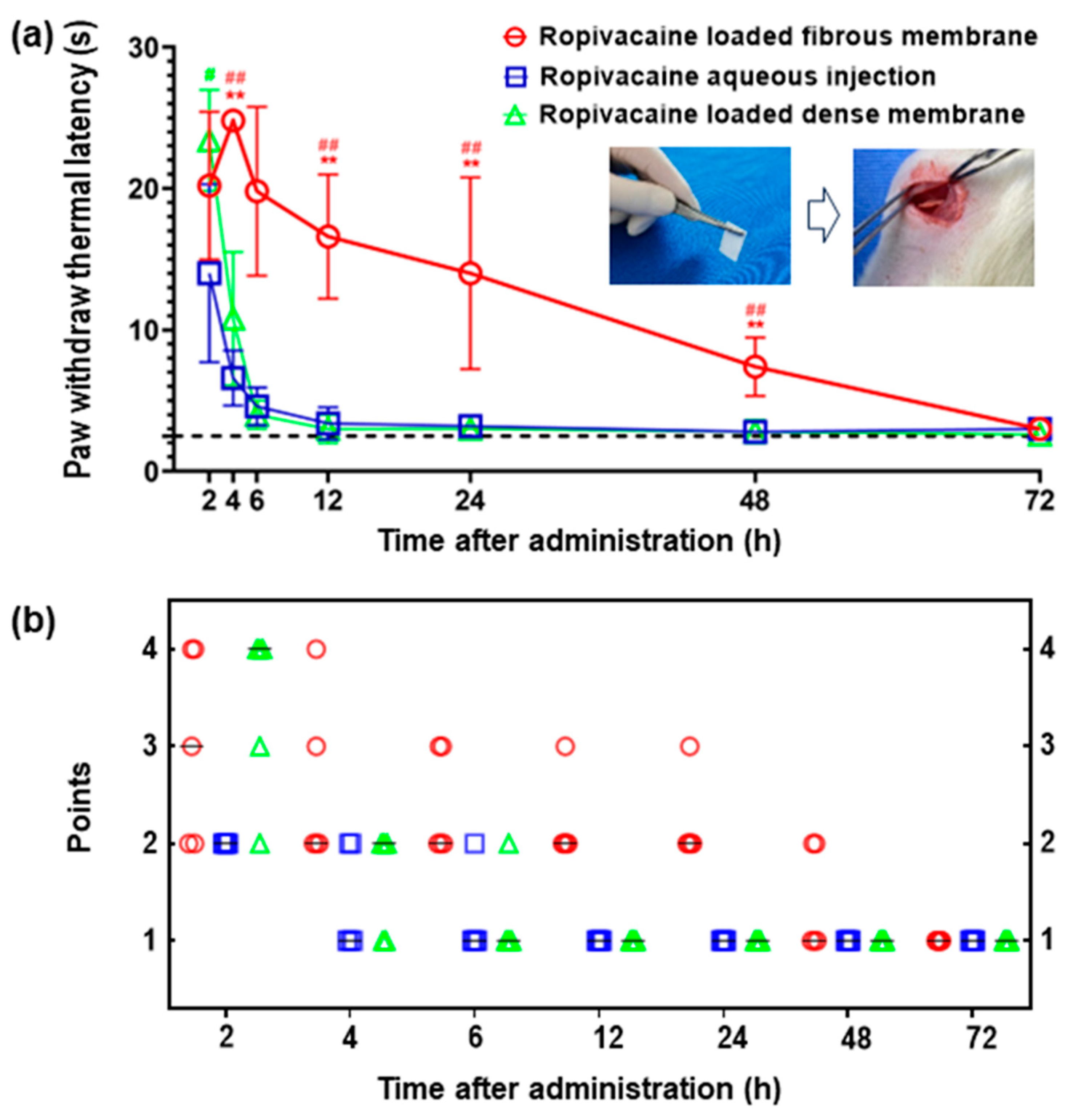 Membranes Free FullText Prolonged Anesthesia Effects of Locally