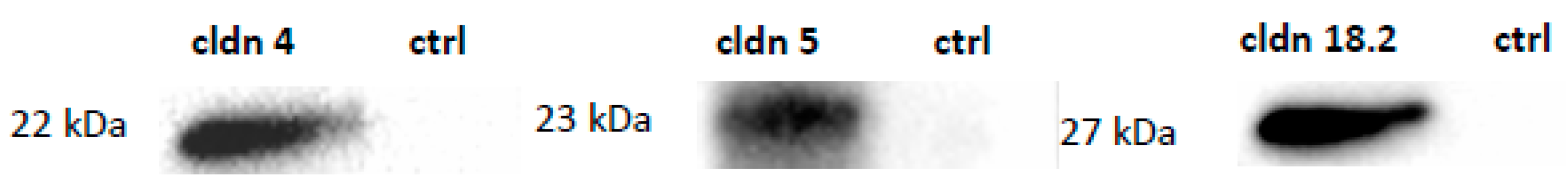 Membranes 14 00040 g003