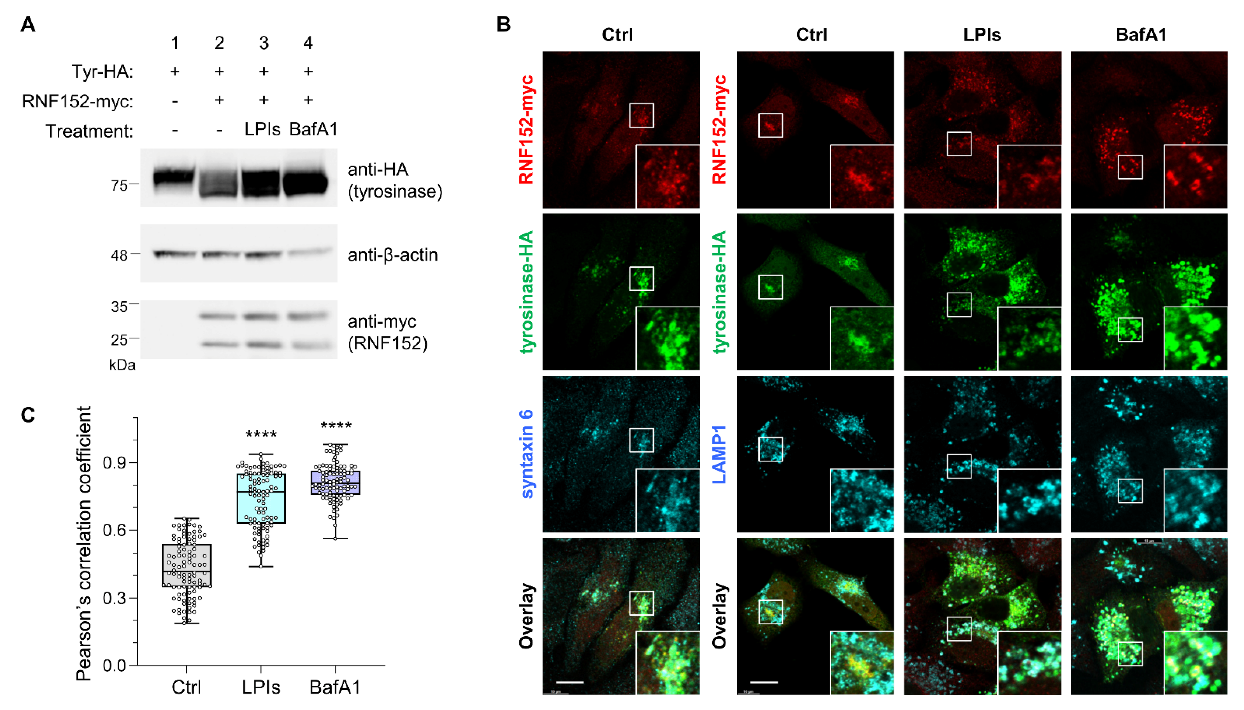 Membranes 14 00043 g003