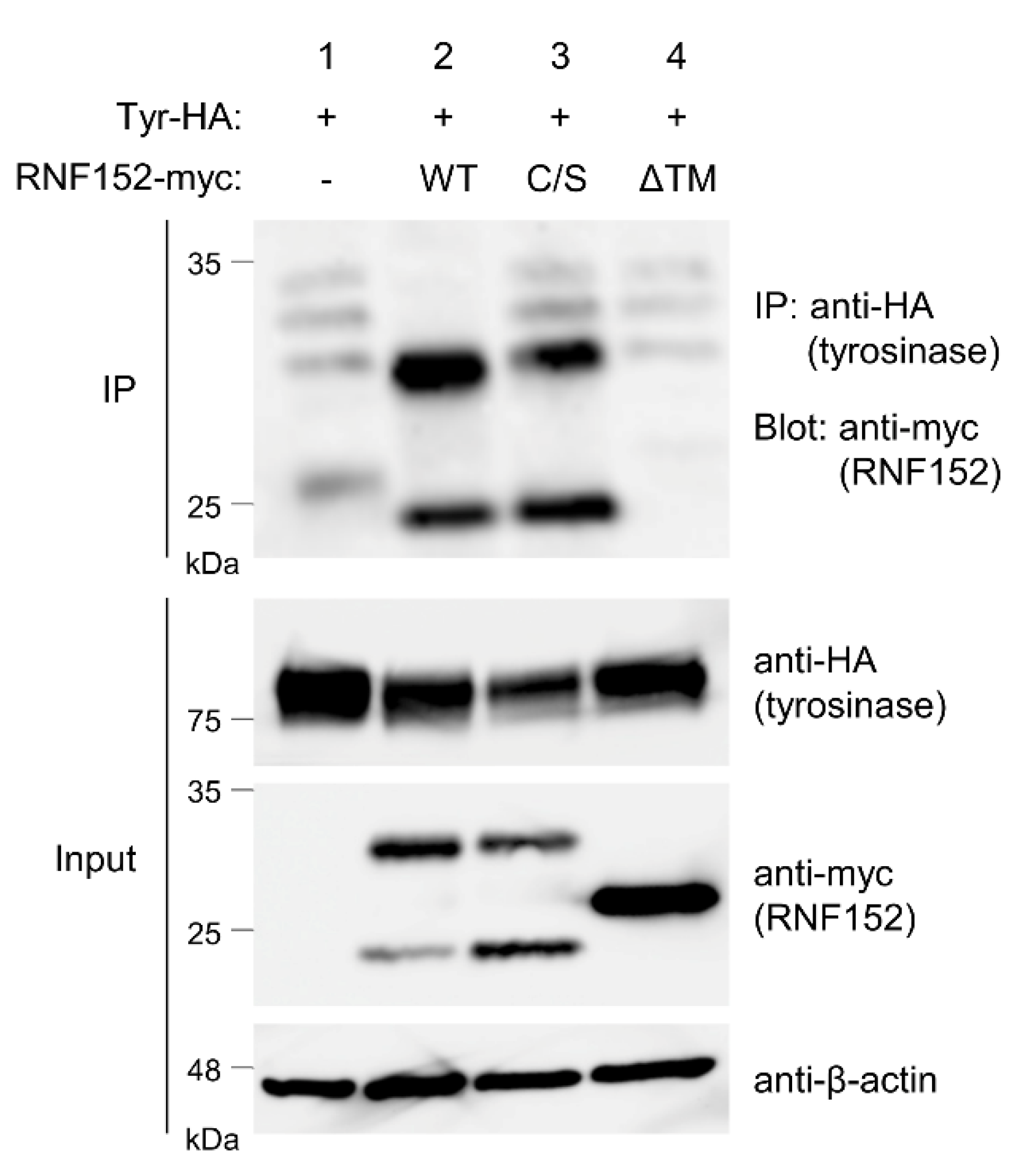 Membranes 14 00043 g004