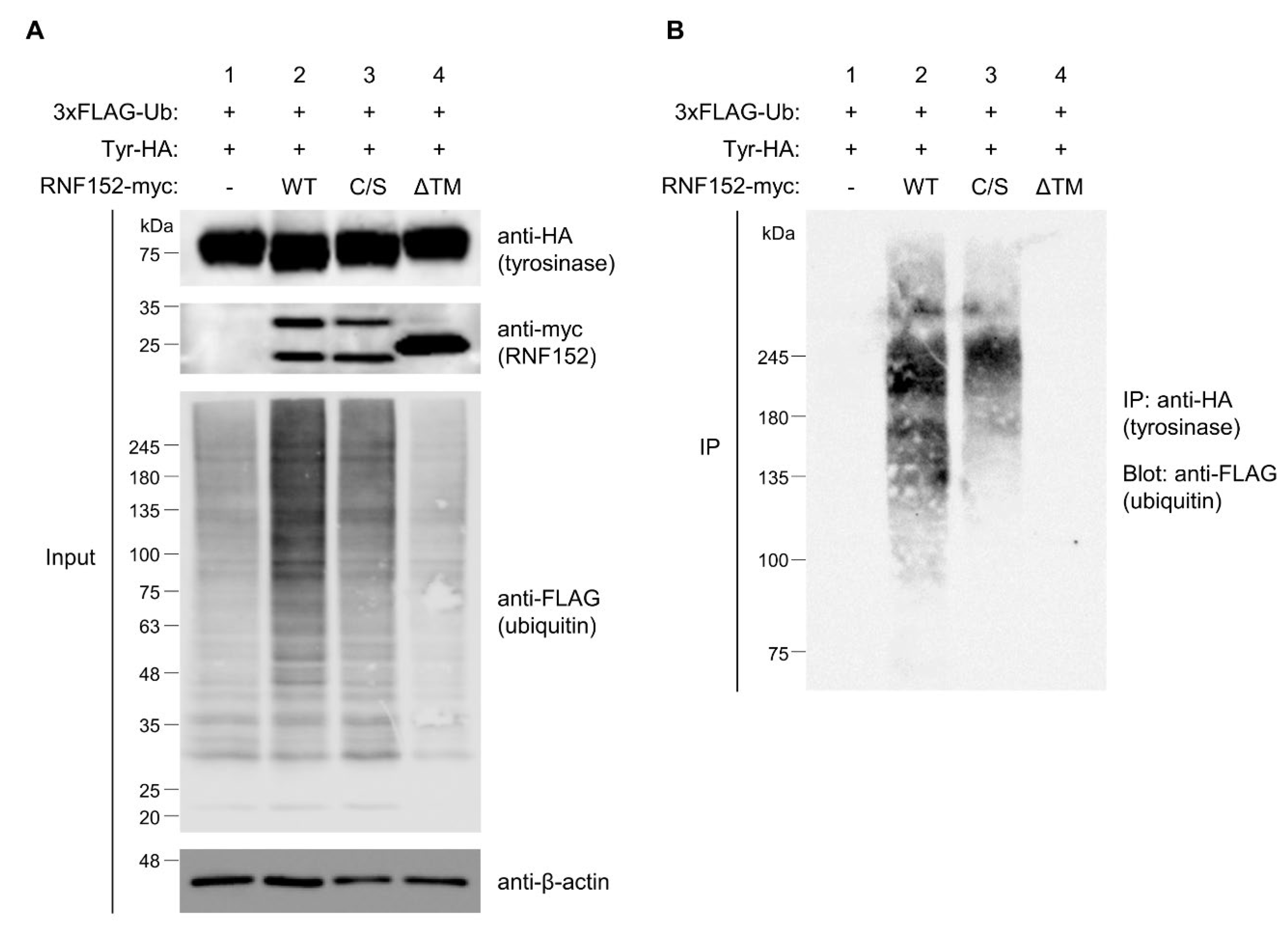 Membranes 14 00043 g005