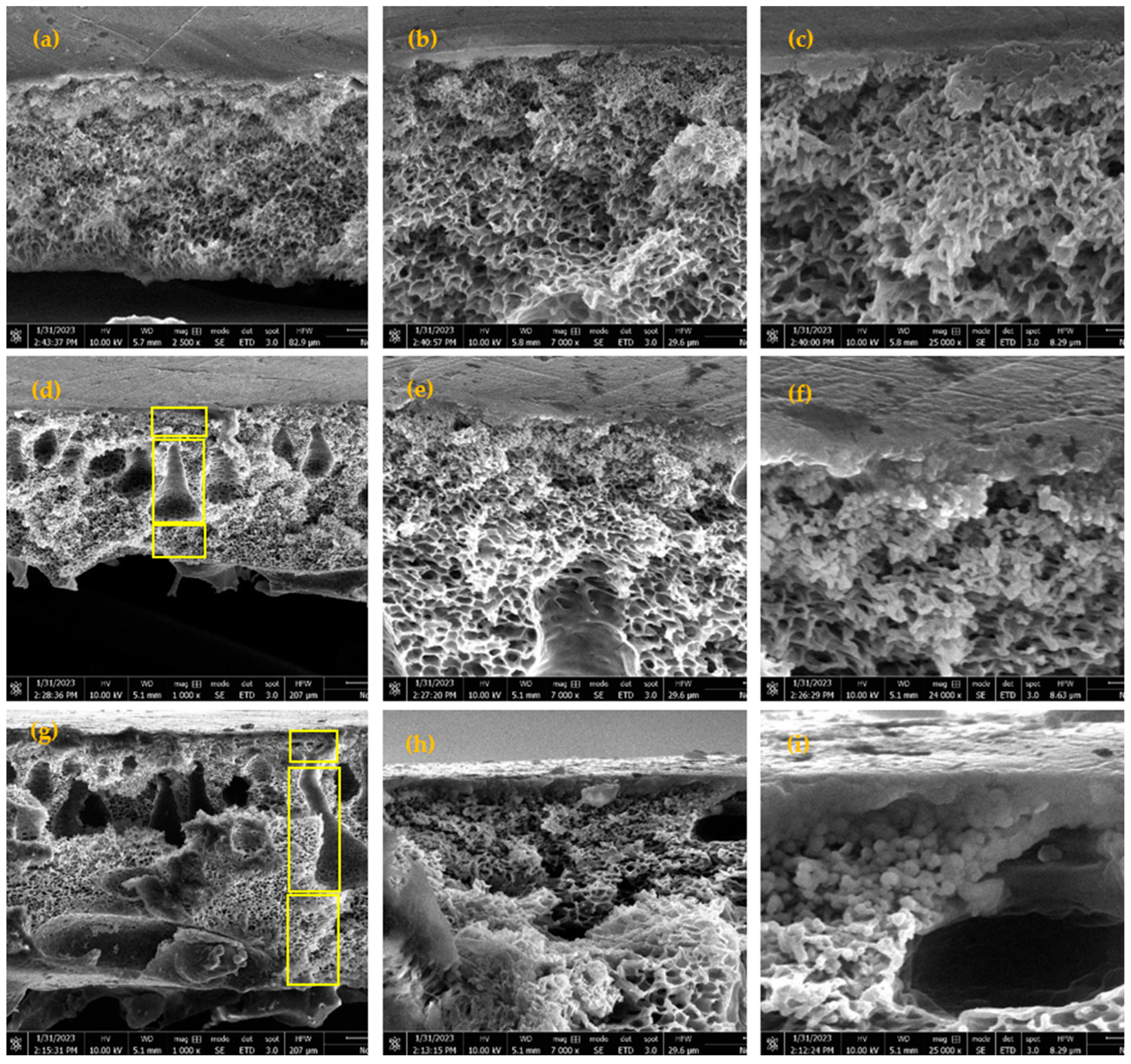 Membranes 14 00116 g005 Membranes 14 00116 g005