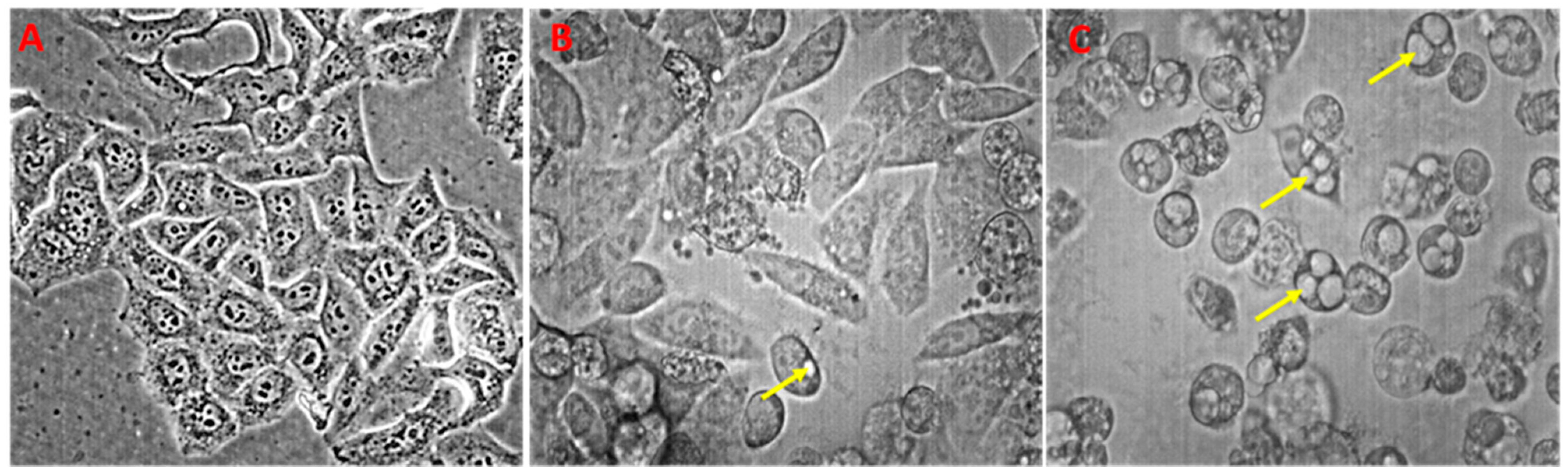 Membranes 14 00218 g004 Membranes 14 00218 g004