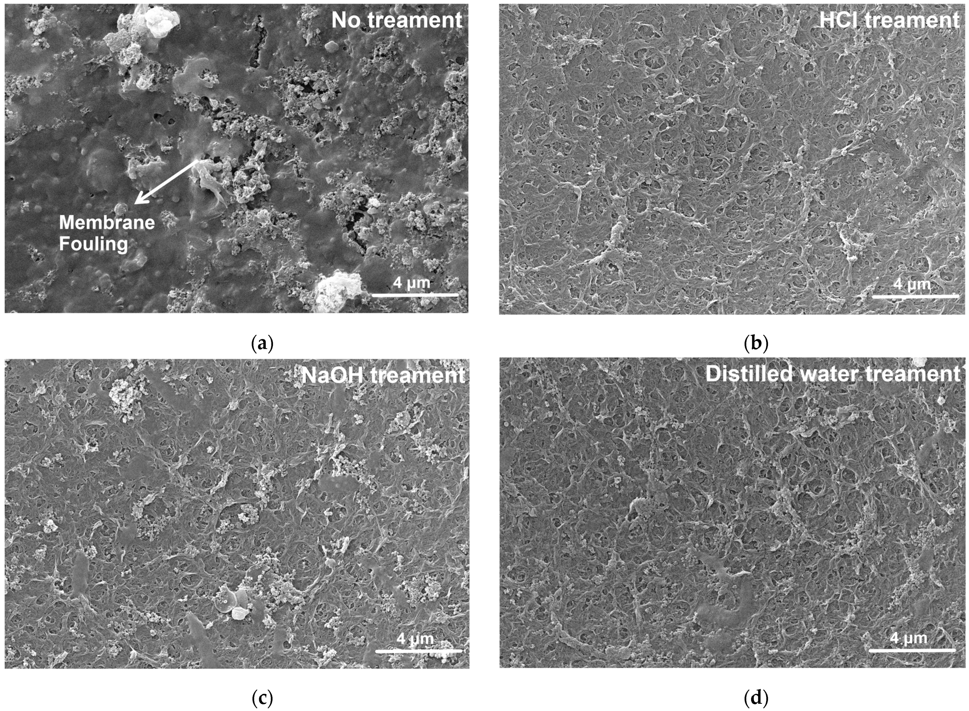 Membranes 14 00266 g005