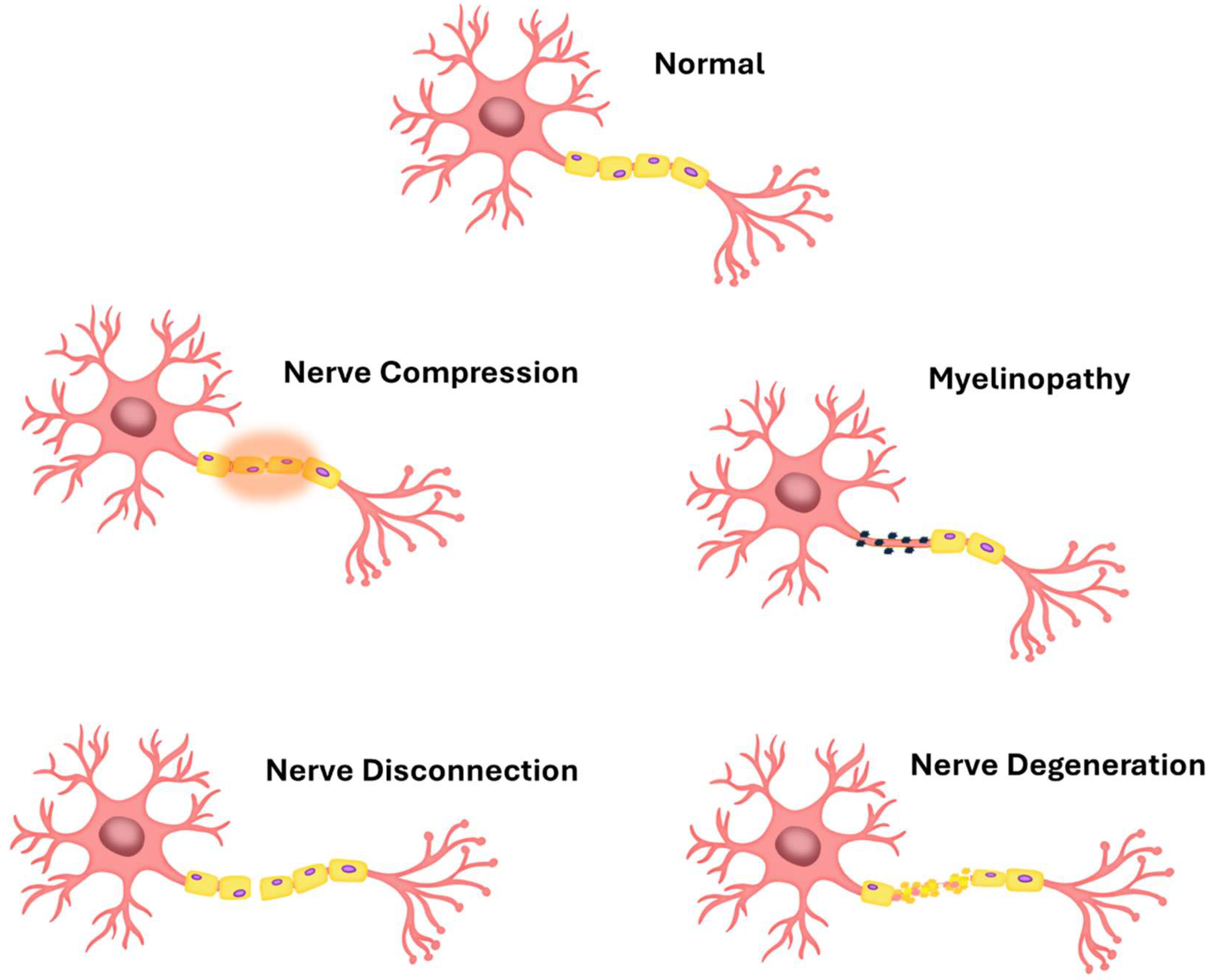 Membranes 15 00313 g001 Membranes 15 00313 g001