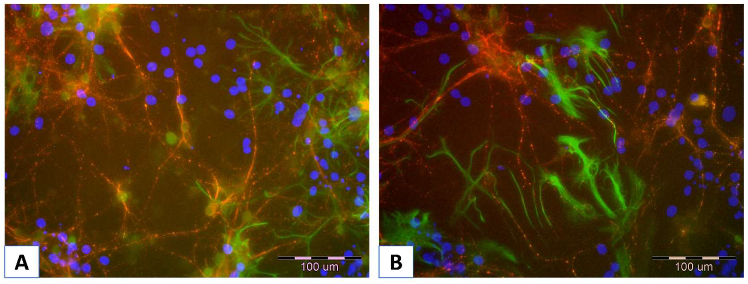 Membranes 15 00313 g003 Membranes 15 00313 g003