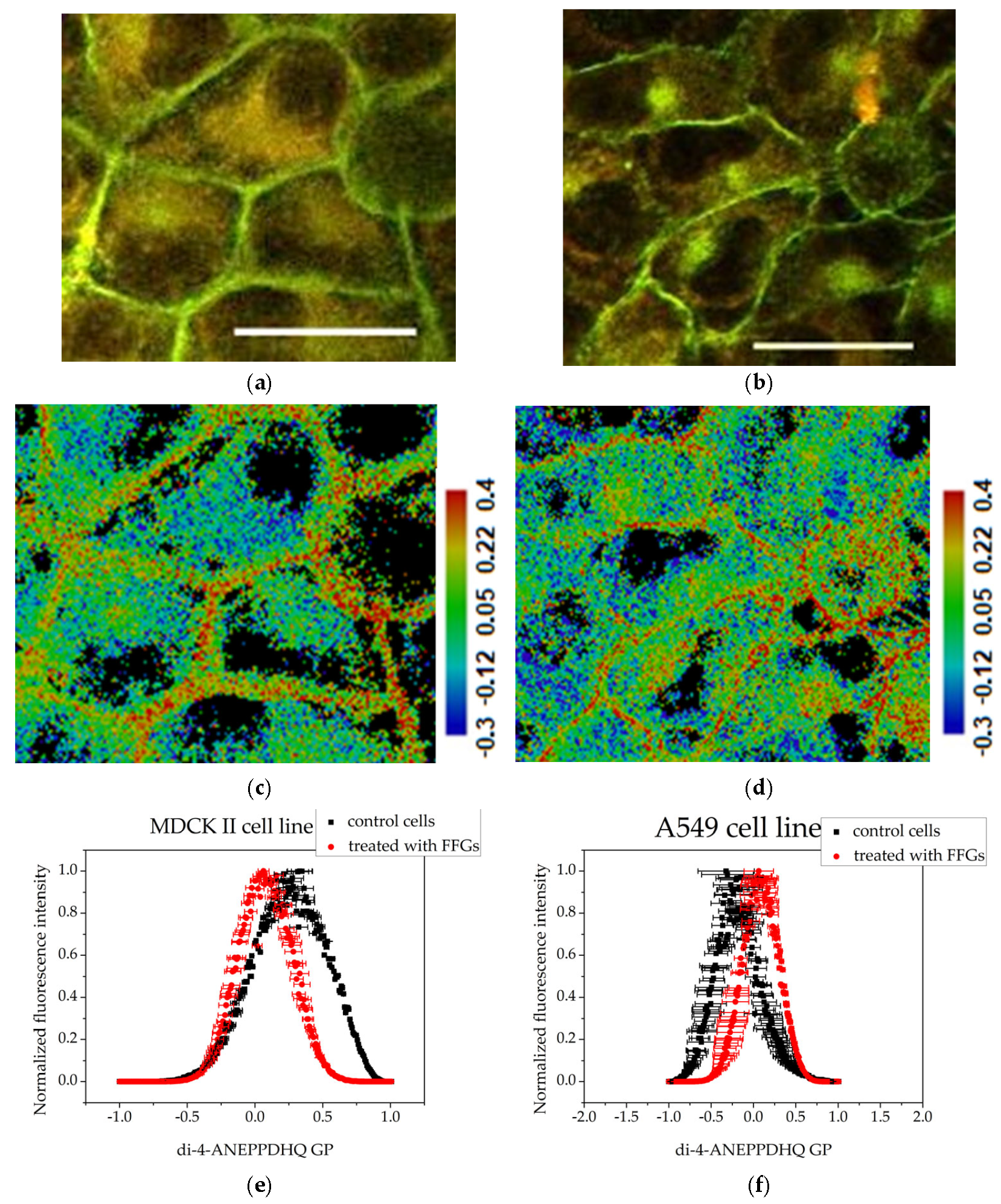 Membranes 15 00357 g004