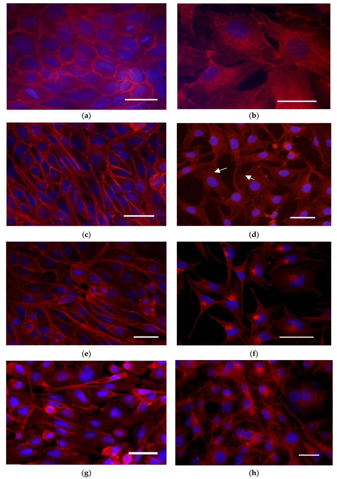 Membranes 15 00357 g006