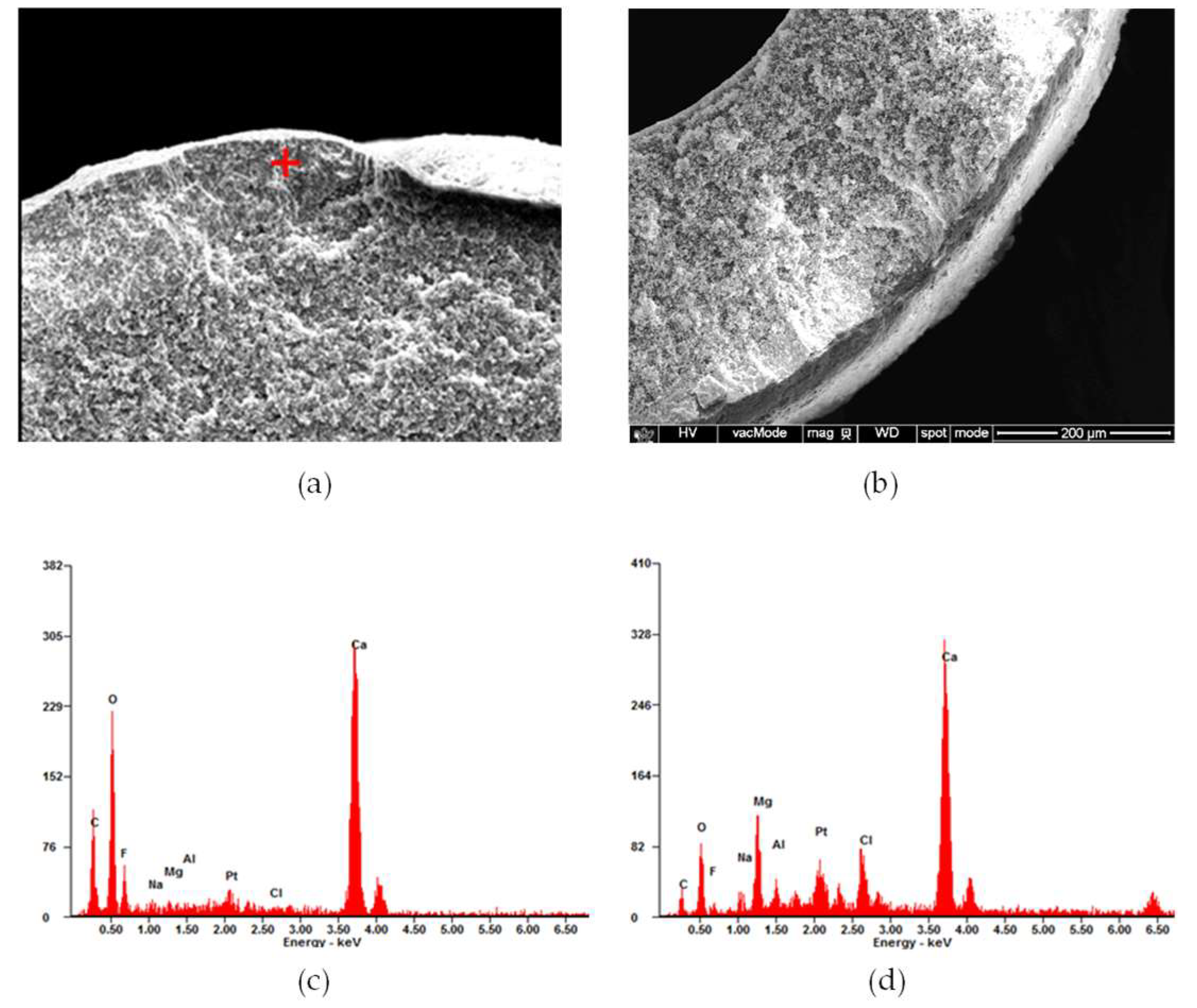 Membranes 15 00371 g013 Membranes 15 00371 g013
