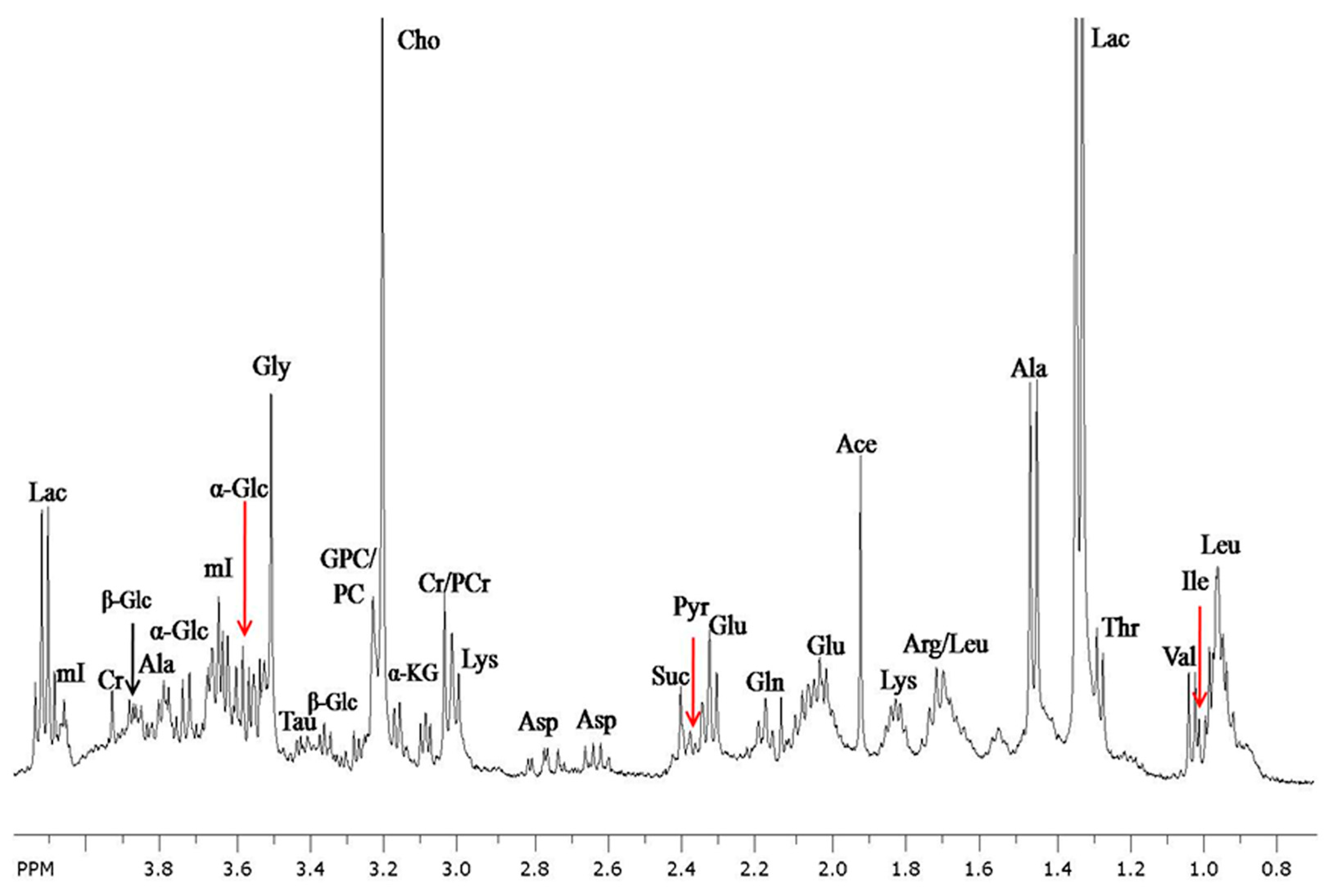 mri spectroscopy breast metabolic peaks Mri spectroscopy breast metabolic peaks