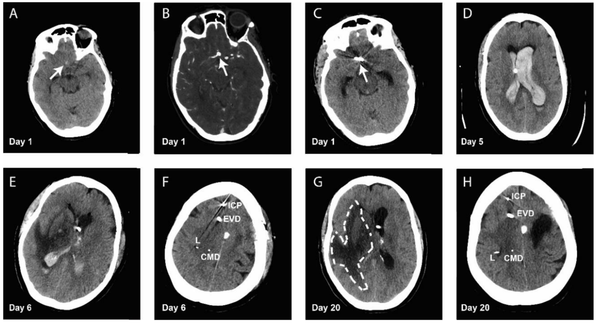 Metabolites 10 00341 g001