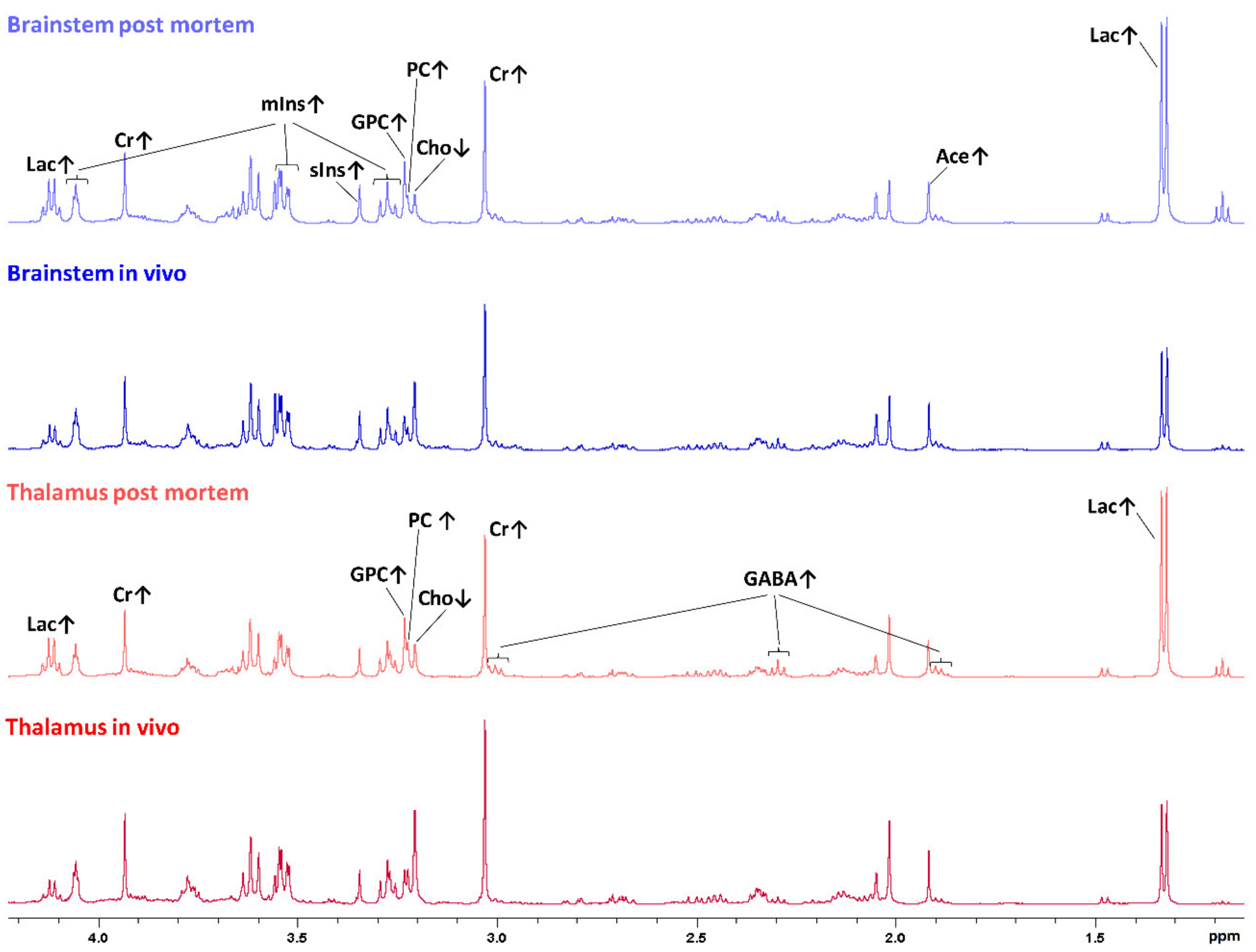 Metabolites 11 00038 g002 Metabolites 11 00038 g002