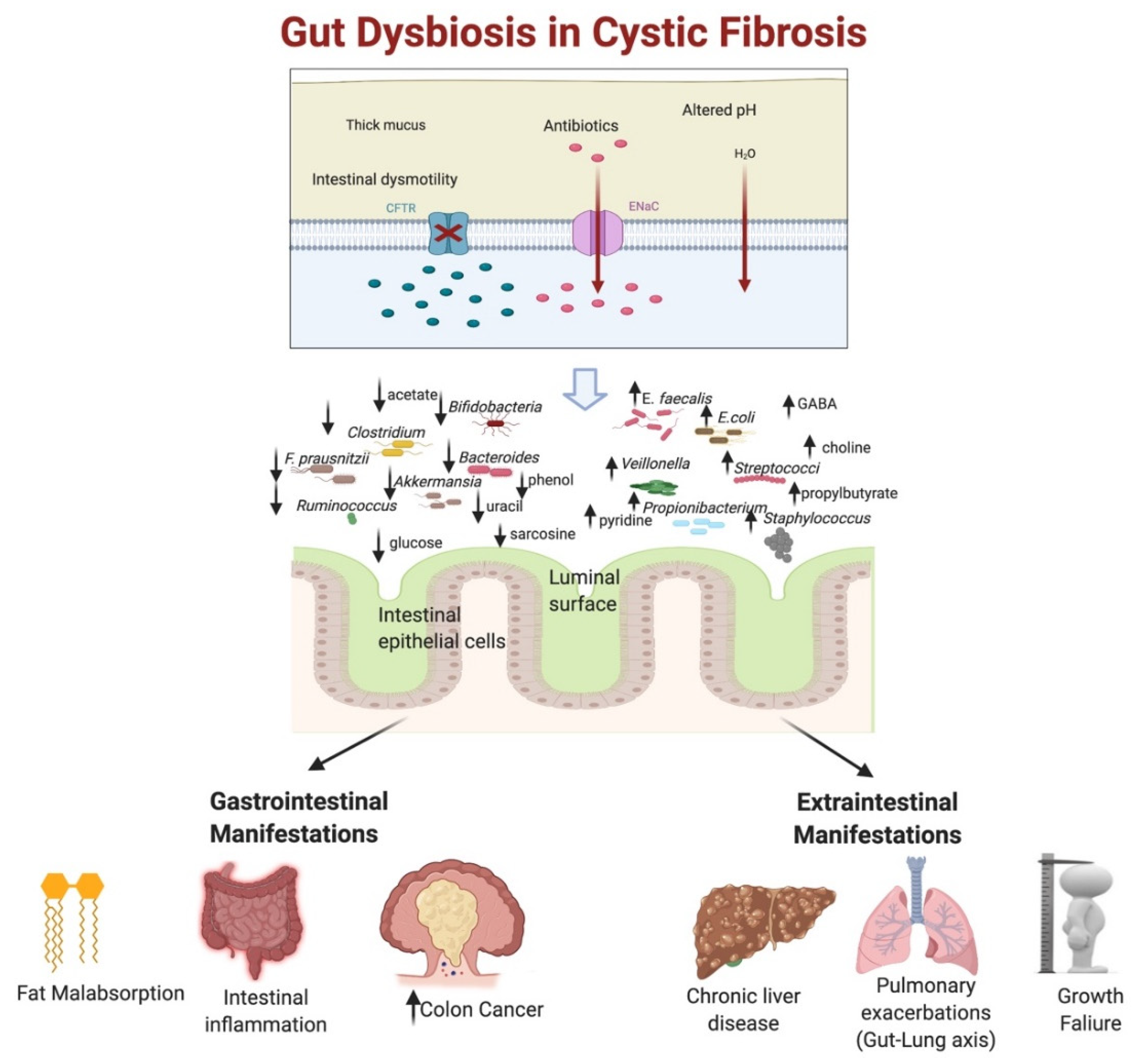 3001px x 2817px - Metabolites | Free Full-Text | Impact of Altered Gut Microbiota and Its  Metabolites in Cystic Fibrosis
