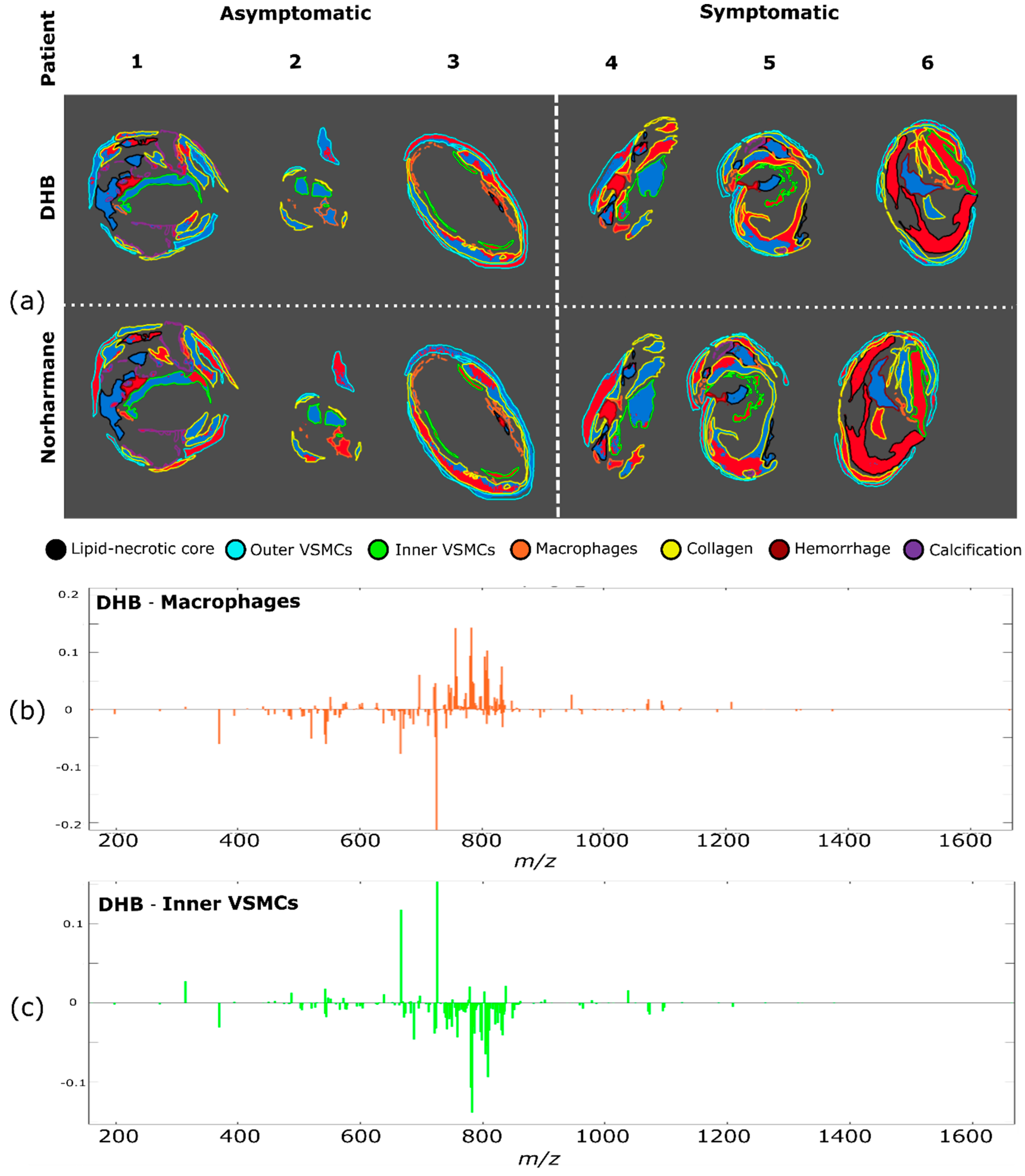 Metabolites 11 00250 g004 Metabolites 11 00250 g004
