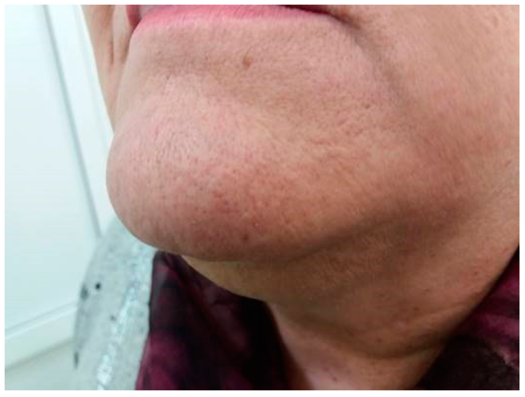 Metabolites 12 00620 g001