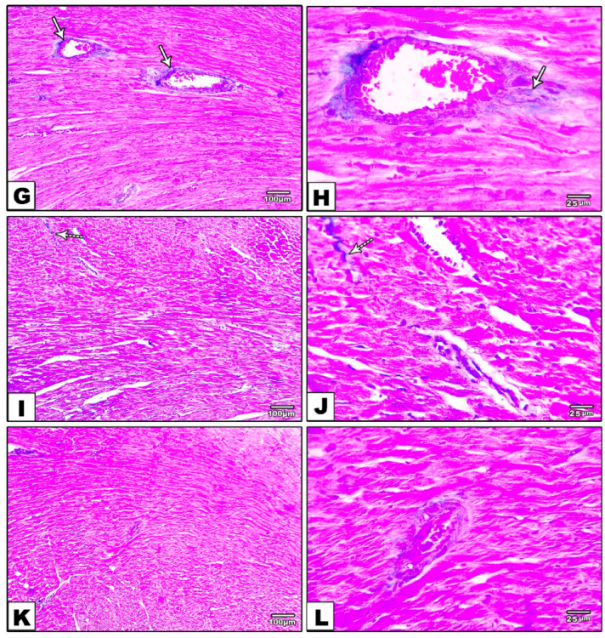 Metabolites 12 00635 g004b 550