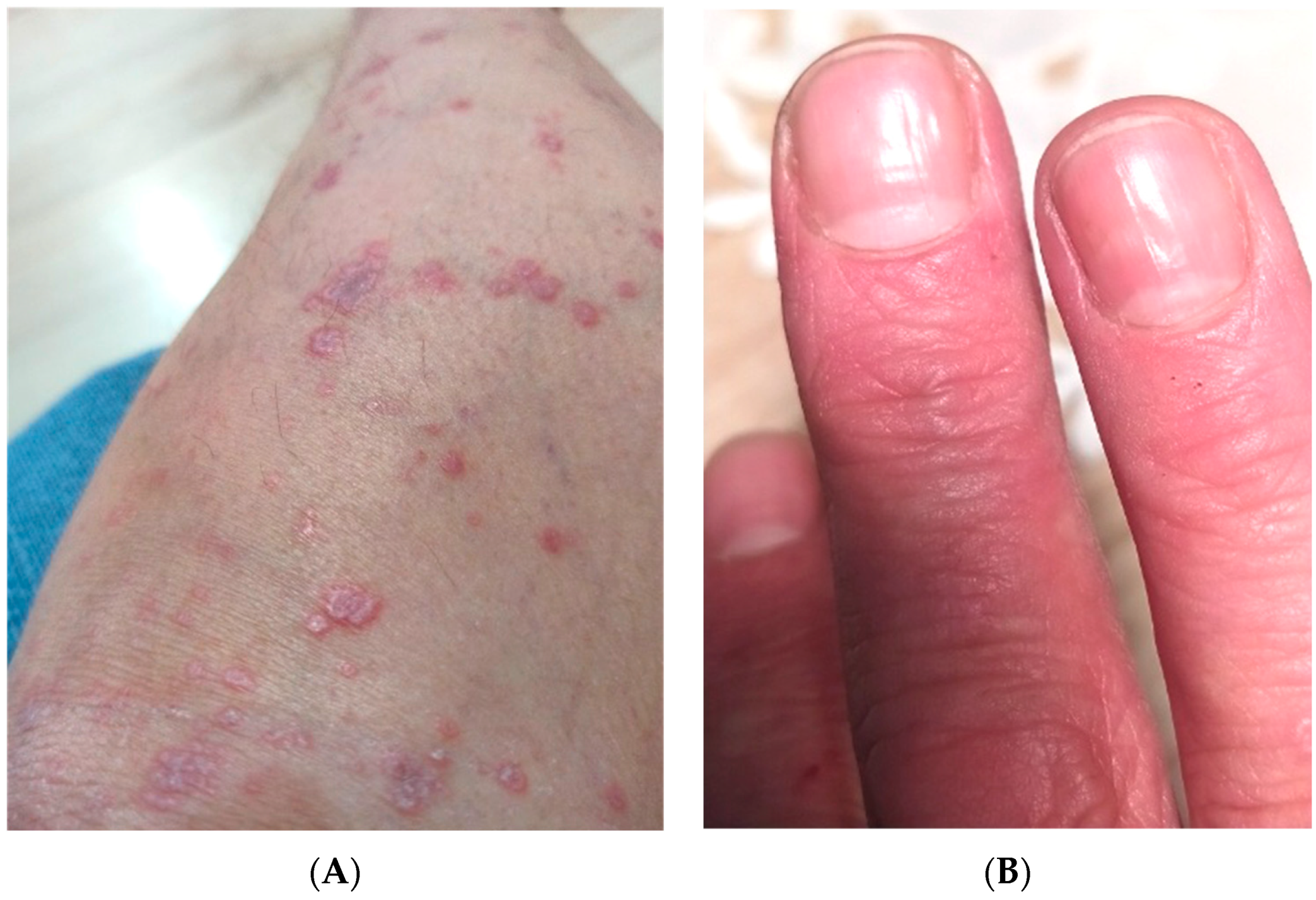 Metabolites 12 01008 g001