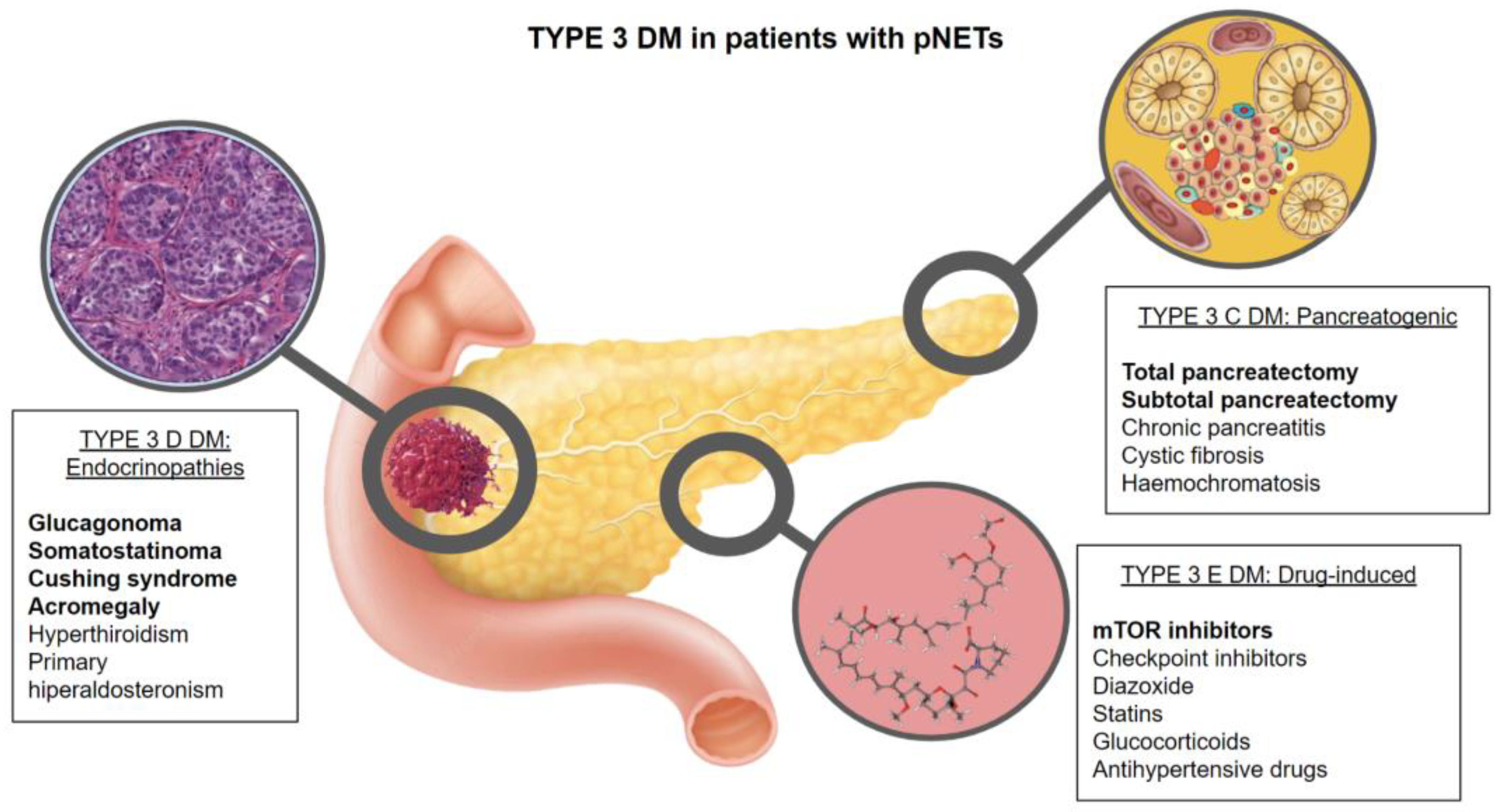 Un quiste se puede convertir en tumor