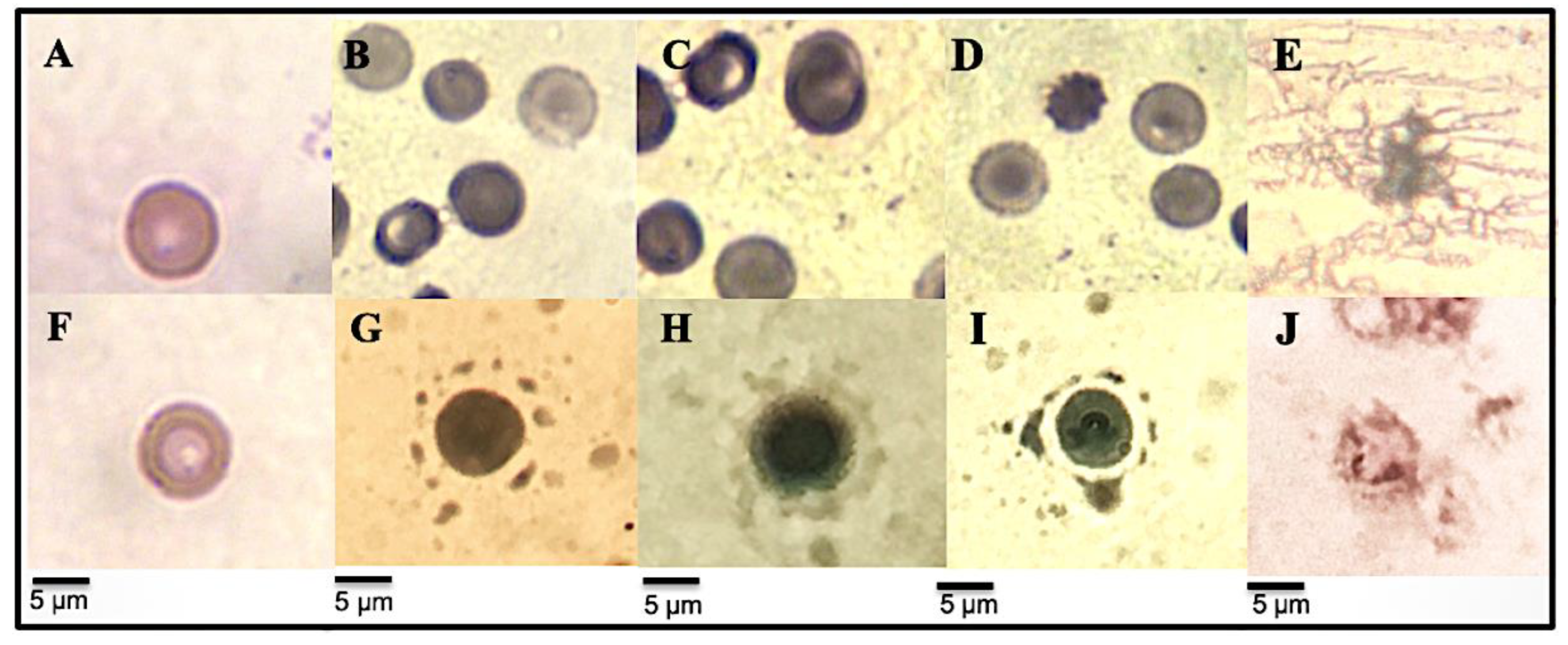 Metabolites 12 01203 g004