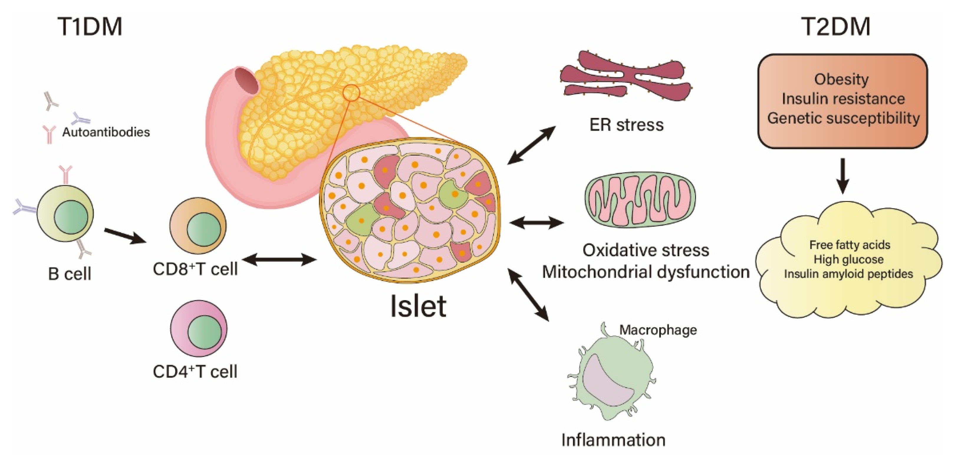 Pancreas diabetes diagram