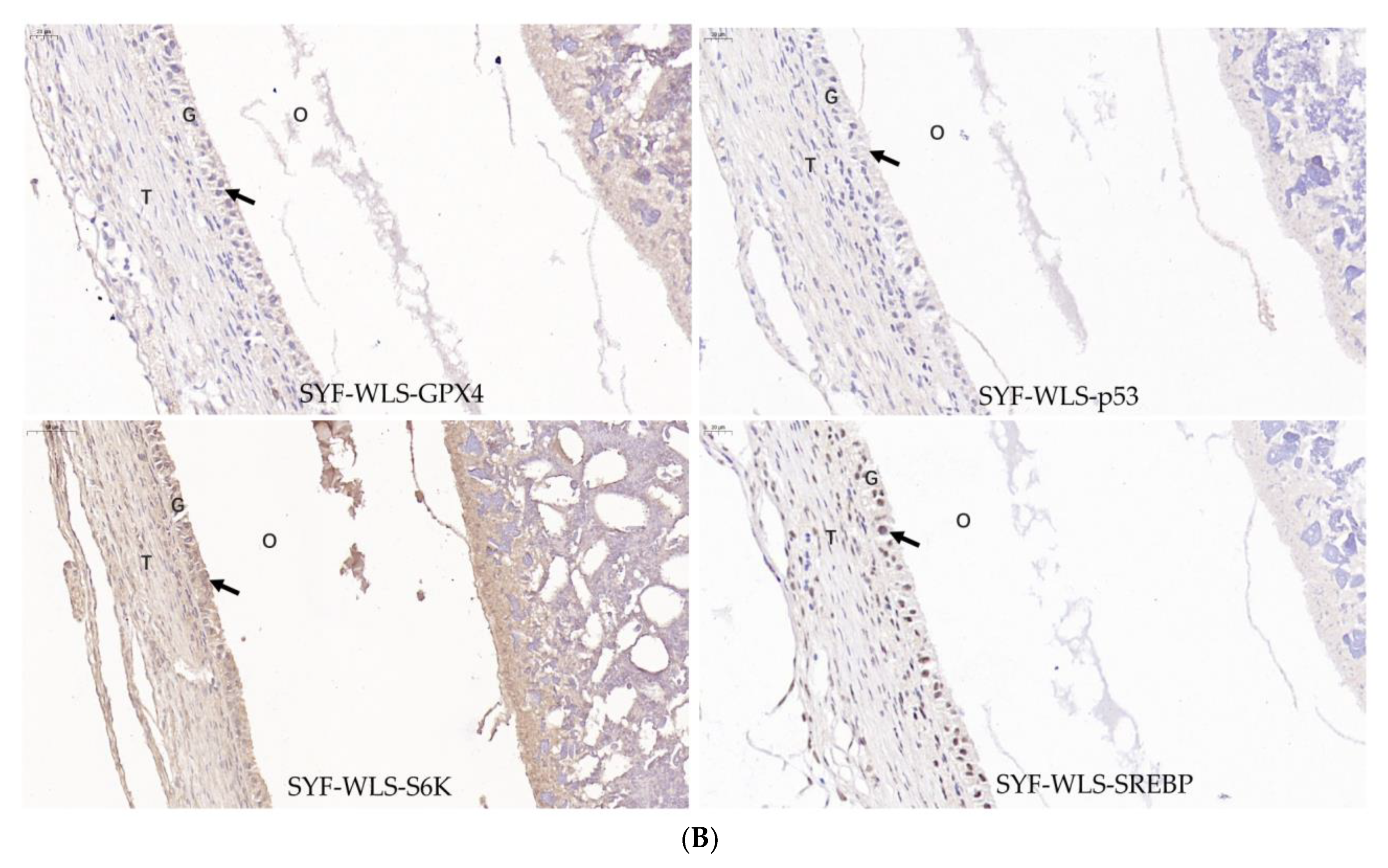 Metabolites 13 00176 g007b Metabolites 13 00176 g007b