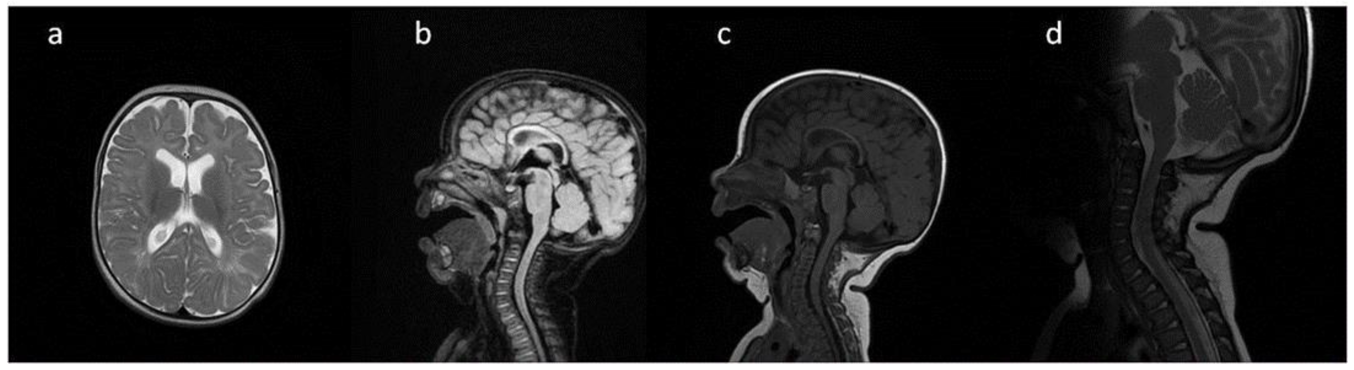 Metabolites 13 00209 g001 Metabolites 13 00209 g001