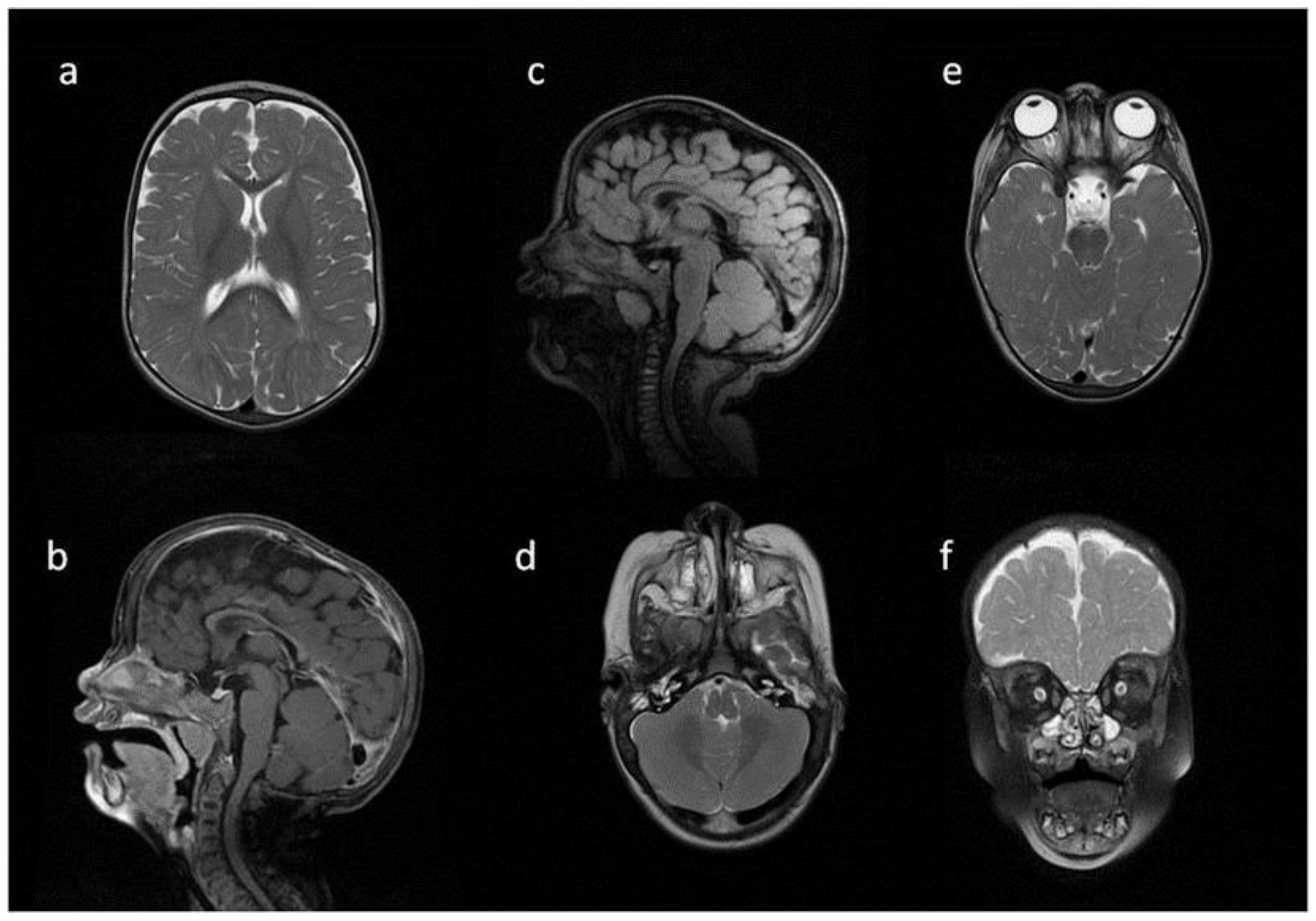 Metabolites 13 00209 g003 Metabolites 13 00209 g003