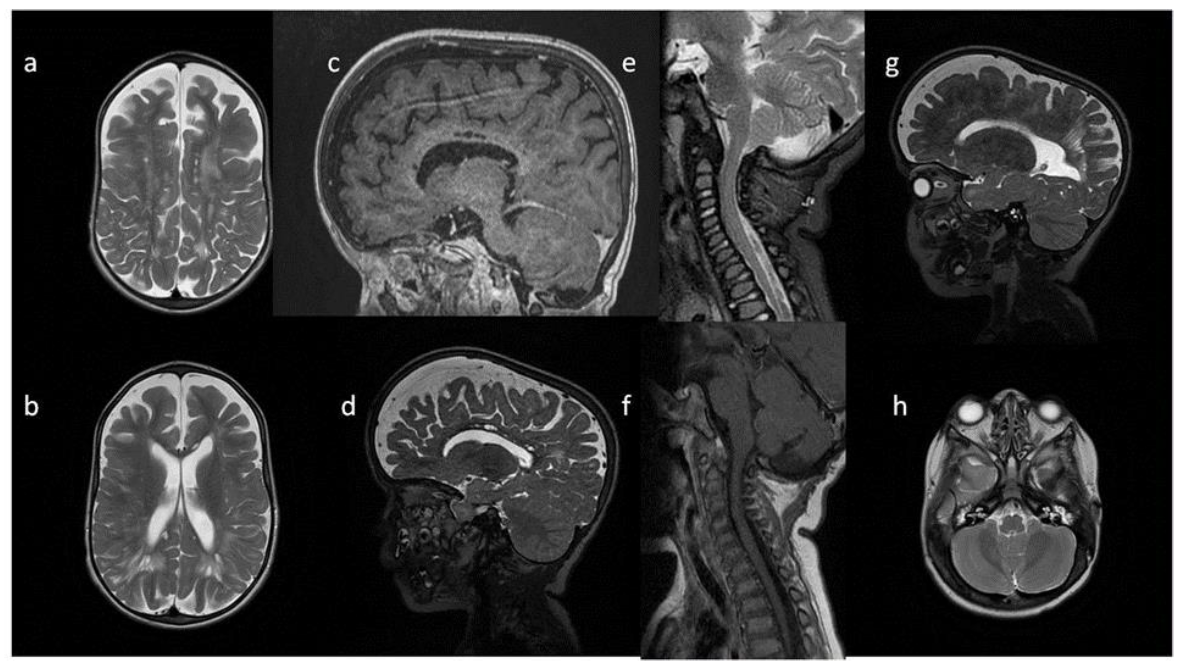 Metabolites 13 00209 g004 Metabolites 13 00209 g004