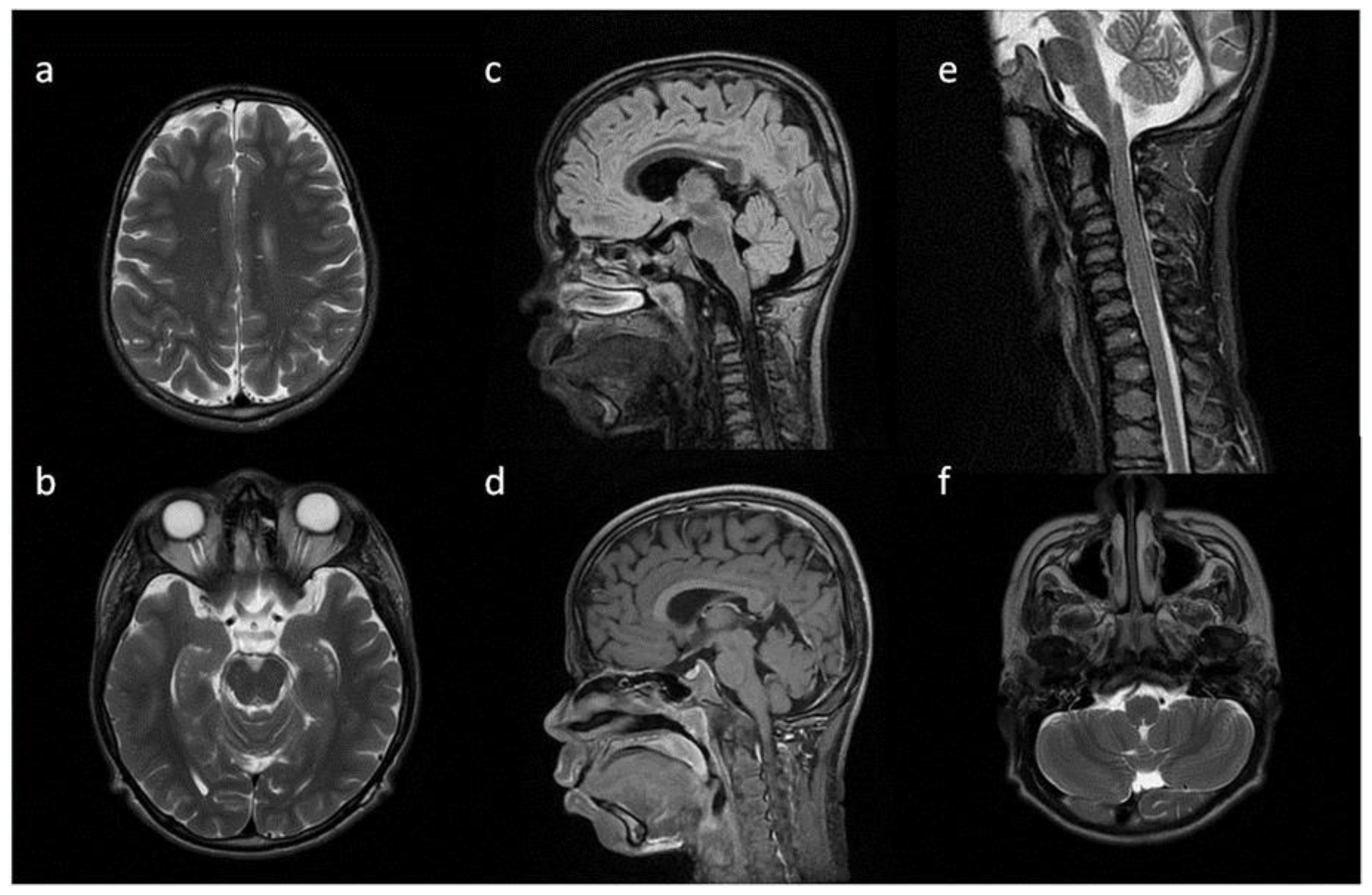 Metabolites 13 00209 g006 Metabolites 13 00209 g006