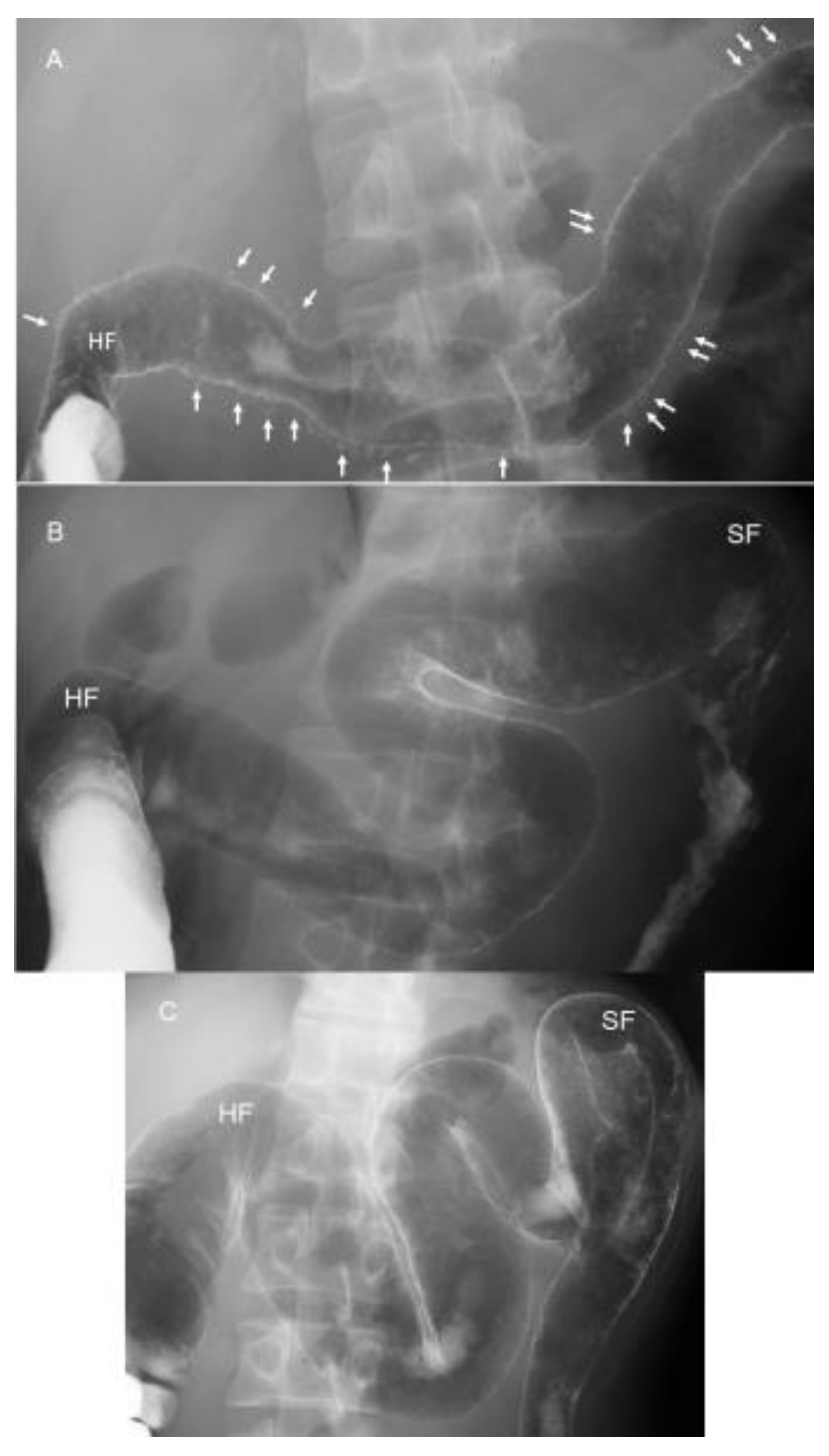 Metabolites 13 00332 g012 Metabolites 13 00332 g012