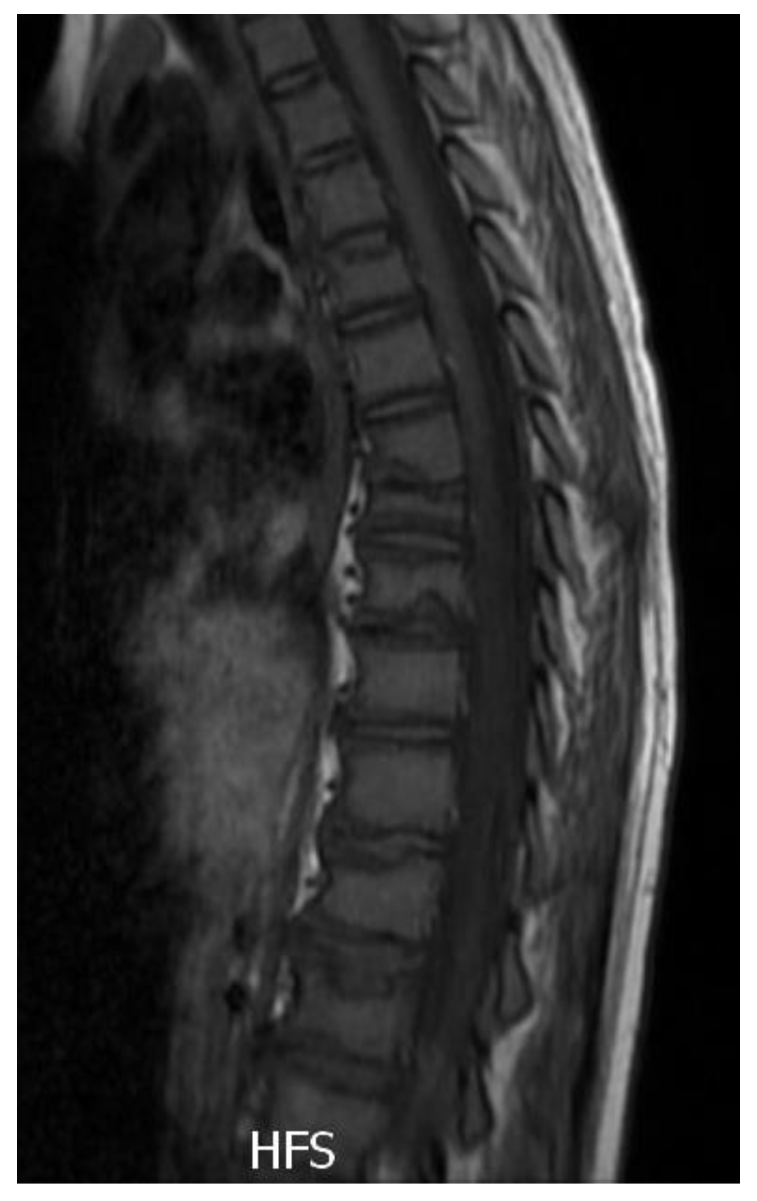 Metabolites 13 00344 g004