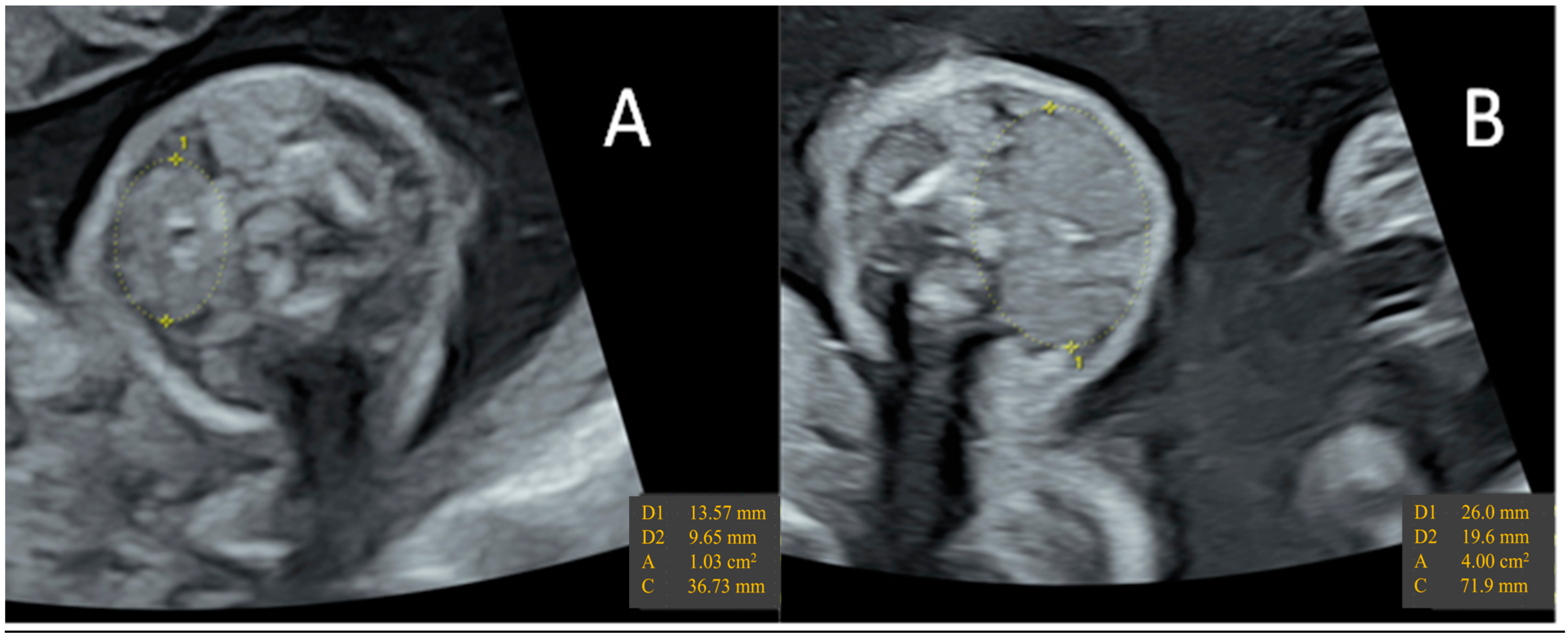 Metabolites 13 00633 g002 Metabolites 13 00633 g002