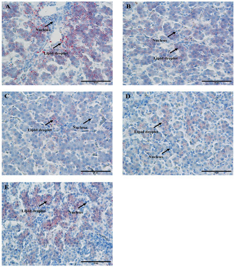 Dietary Coated Sodium Butyrate Ameliorates Hepatic Lipid Accumulation ...