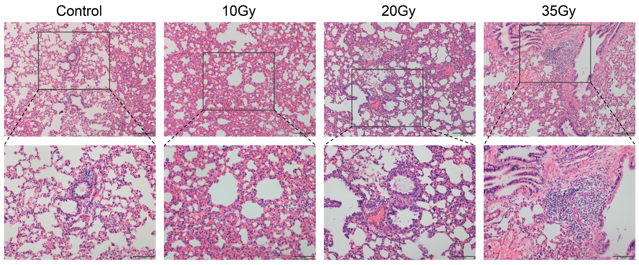 Metabolomic Signatures Associated with Radiation-Induced