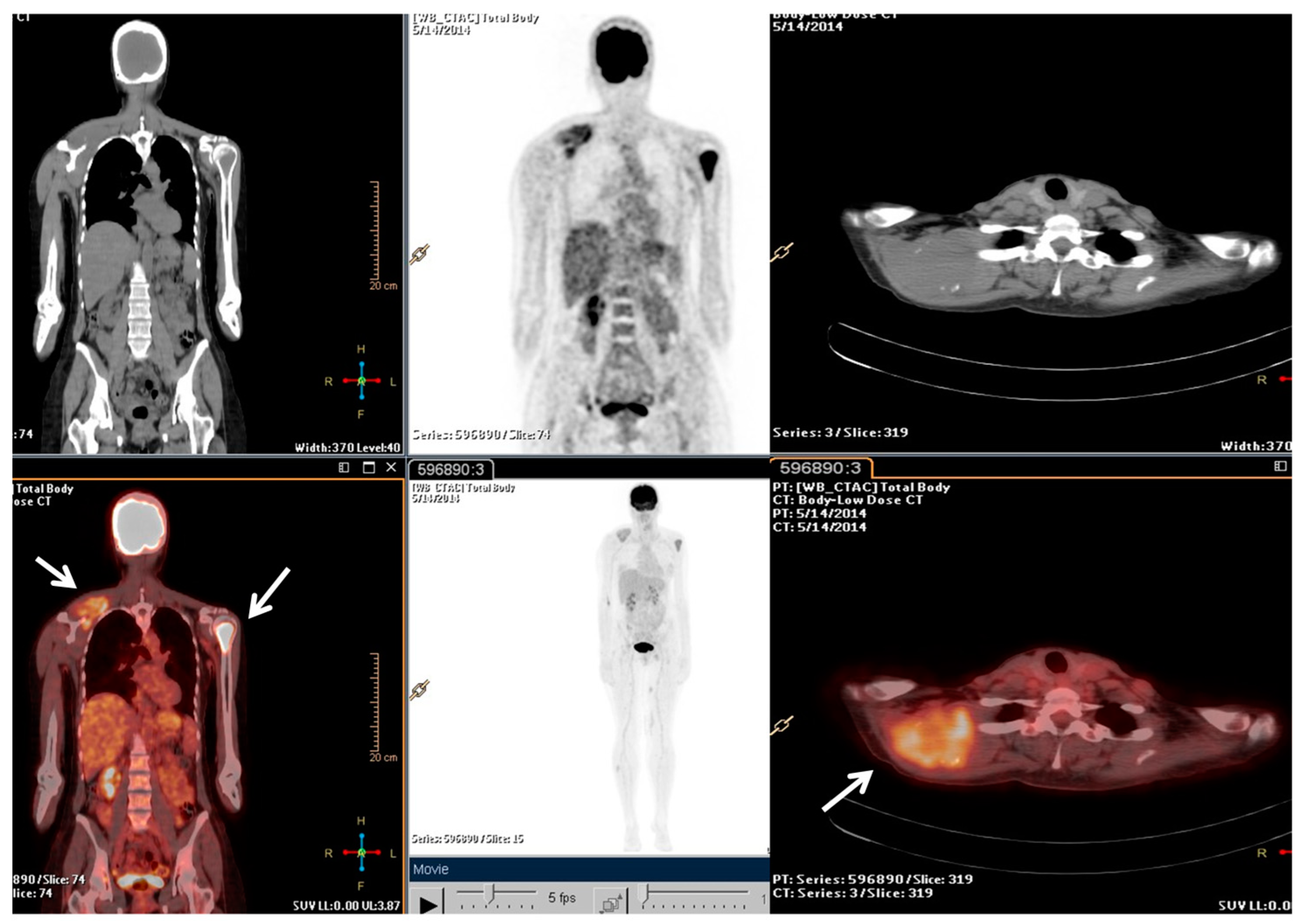Metabolites 13 01035 g001
