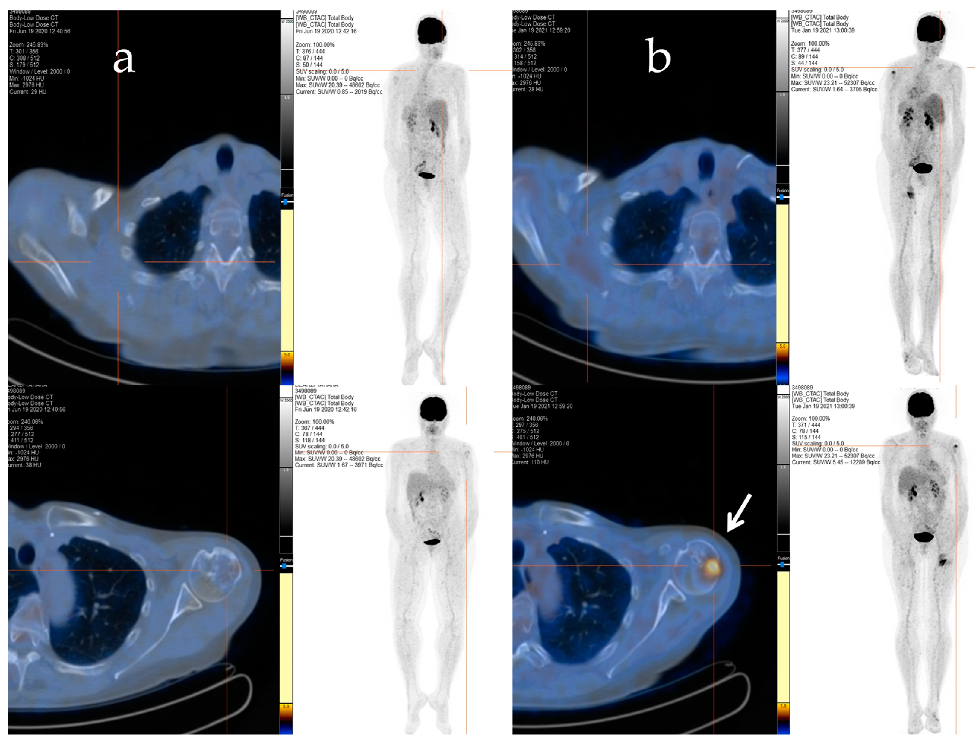 Metabolites 13 01035 g002