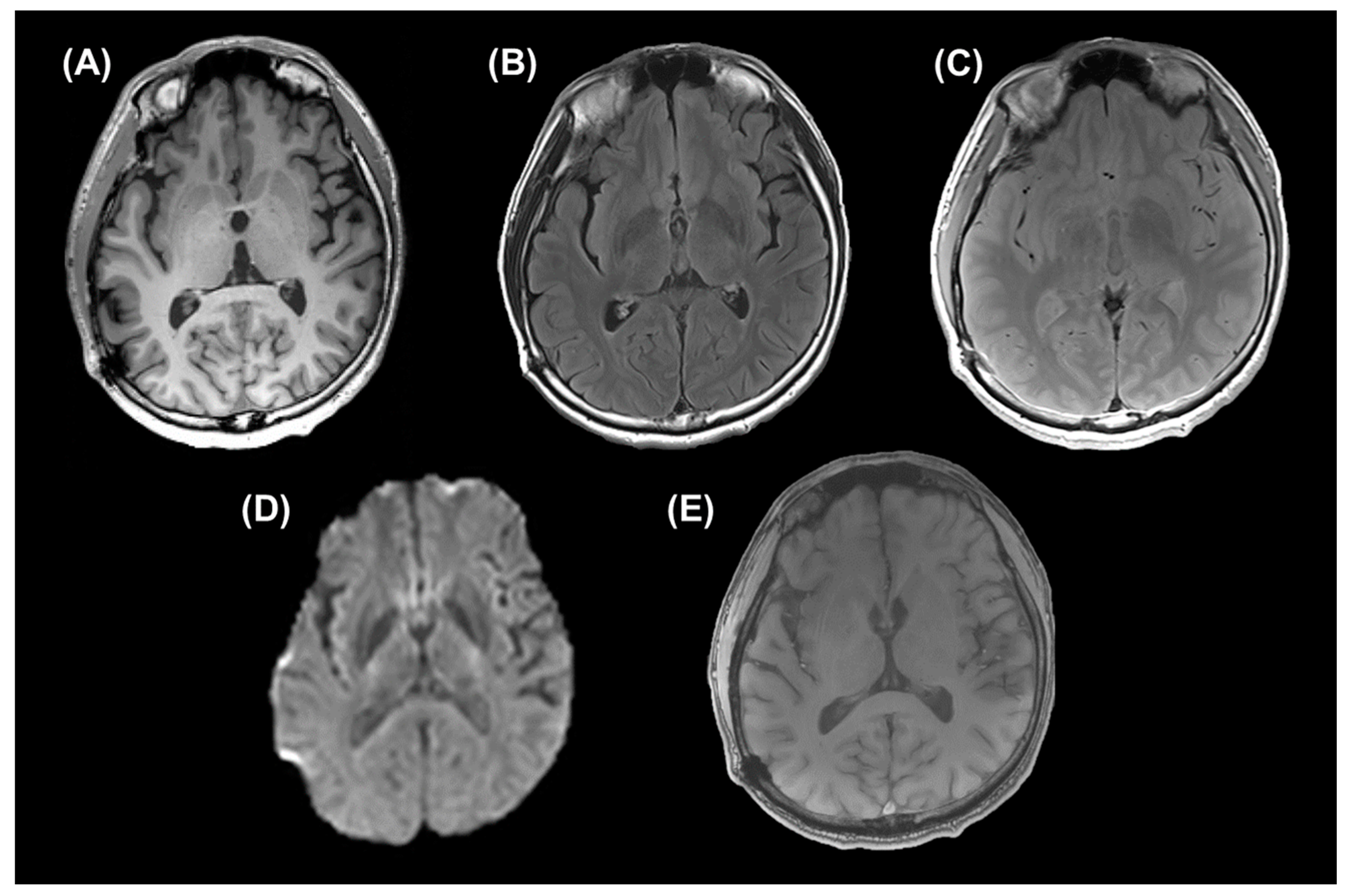Metabolites 14 00017 g002 Metabolites 14 00017 g002